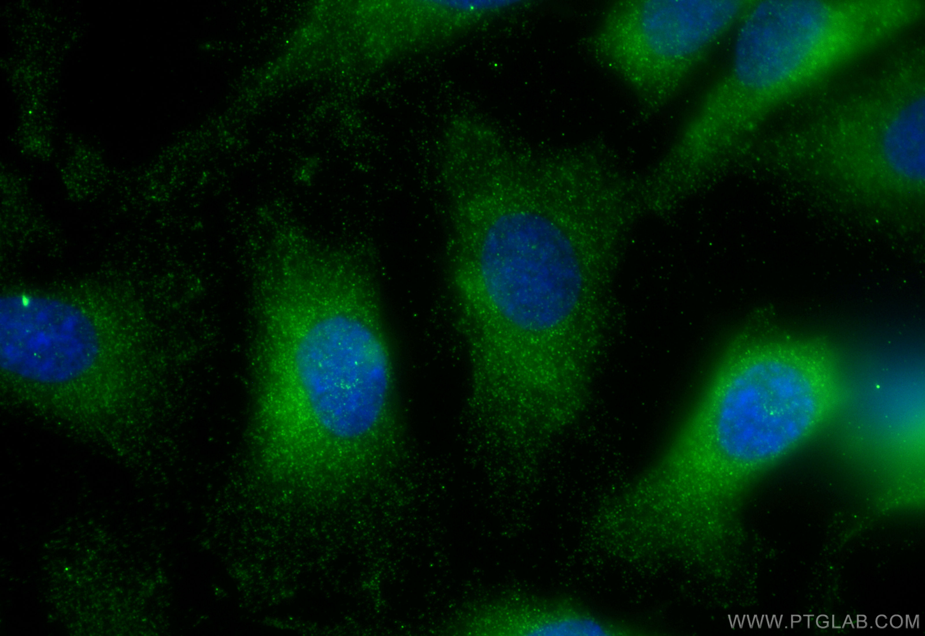 IF Staining of SKOV-3 using 13268-1-AP