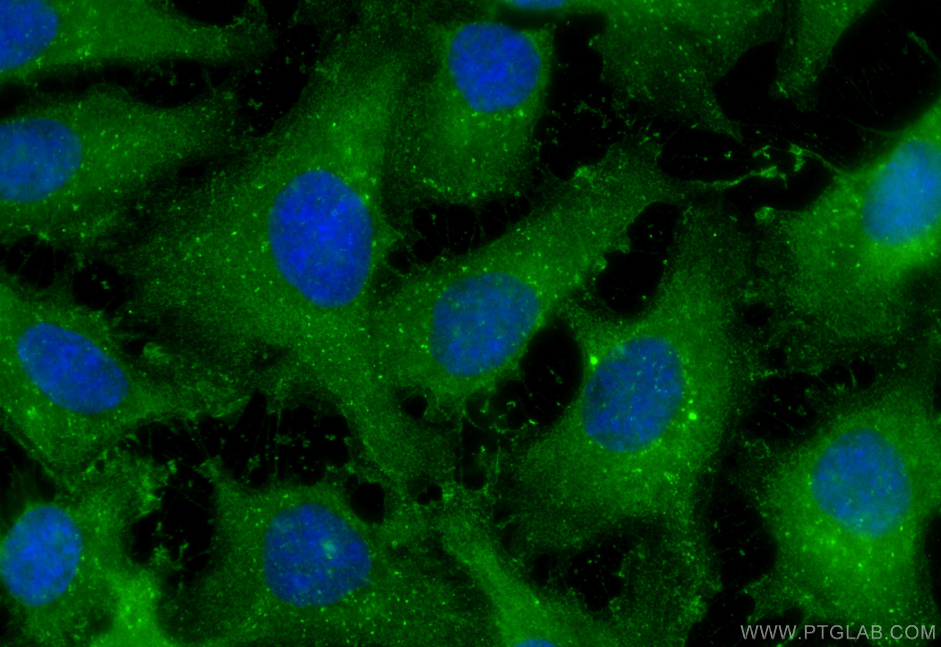 IF Staining of SKOV-3 using 66528-1-Ig