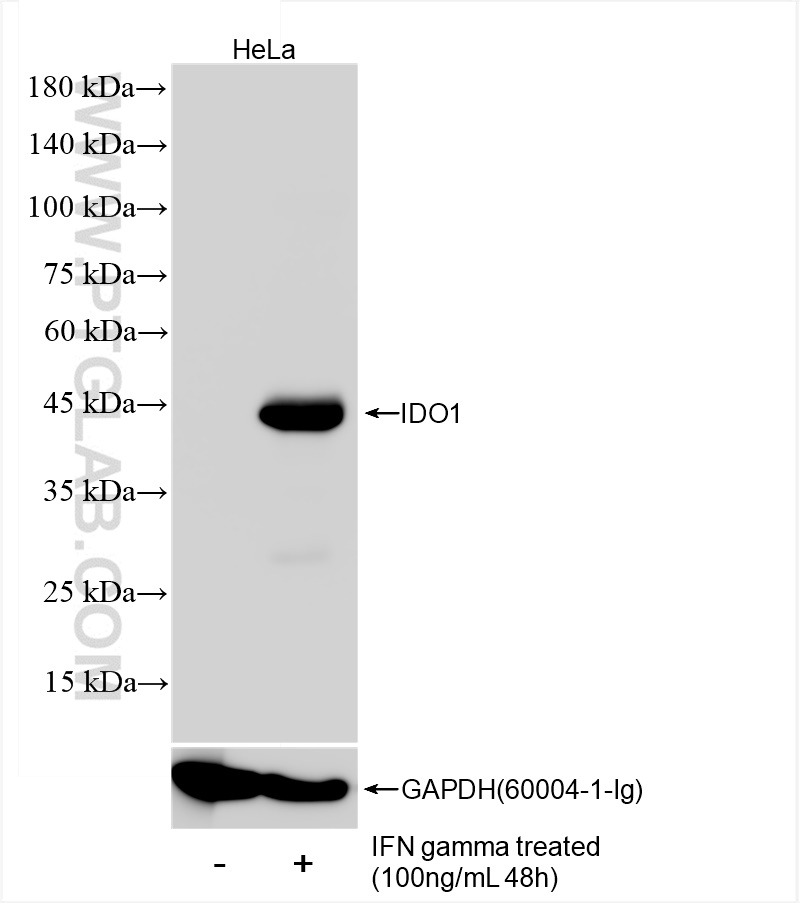 WB analysis of HeLa using 84063-1-RR (same clone as 84063-1-PBS)