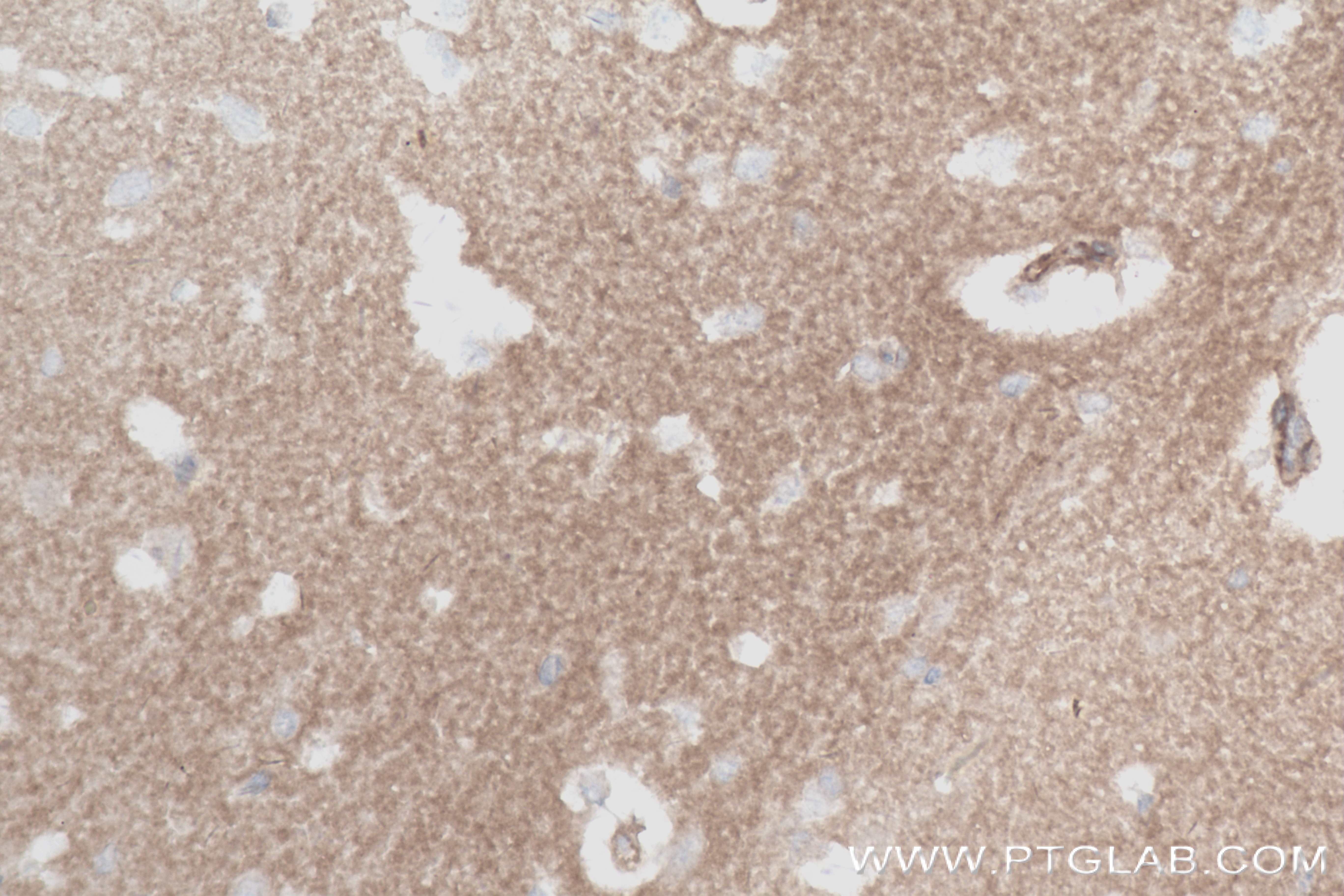 IHC staining of mouse brain using 84063-3-RR