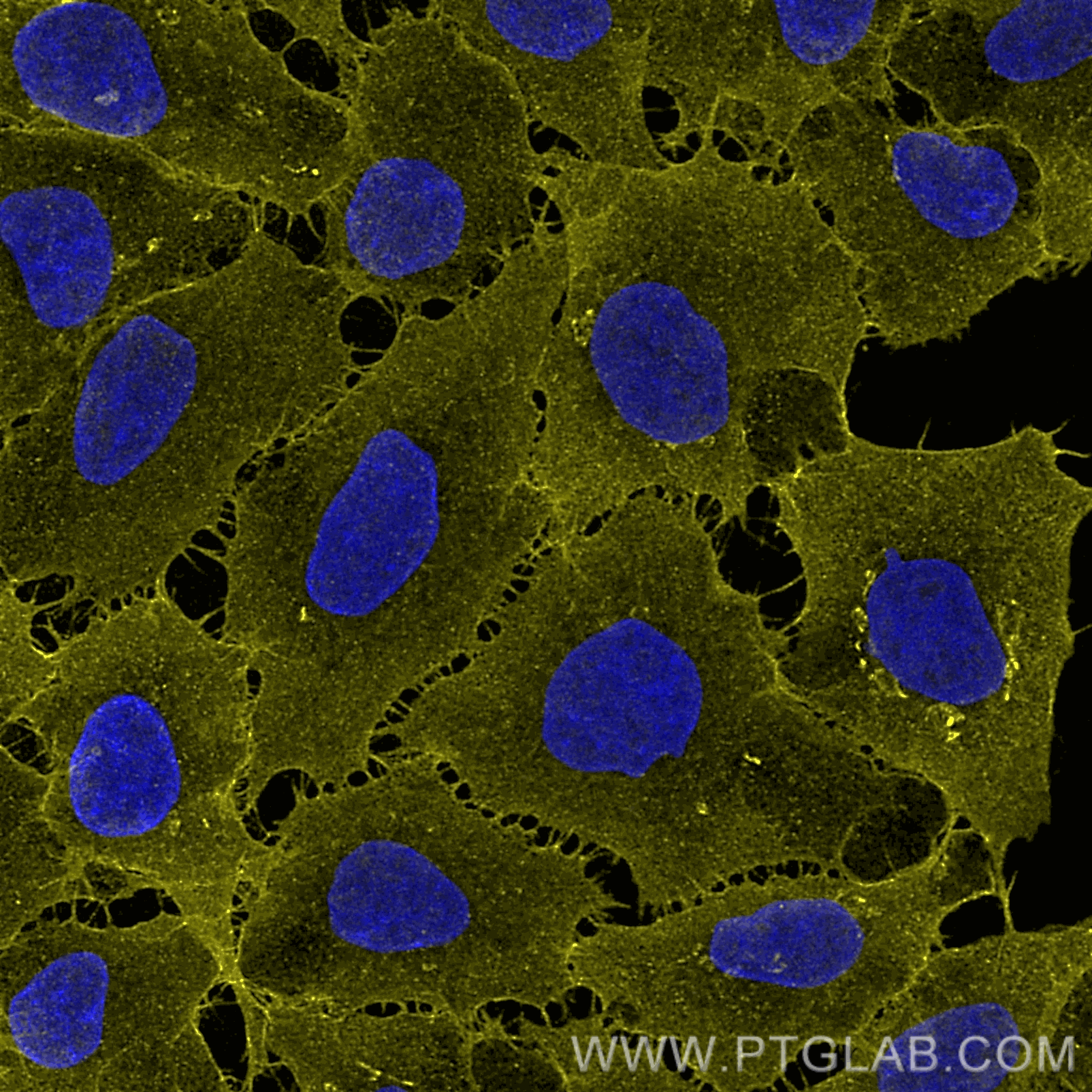 Immunofluorescence of HeLa: PFA-fixed HeLa cells were stained with anti-CD147 antibody labeled with FlexAble Biotin Antibody Labeling Kit for Mouse IgG1 (KFA027) and Streptavidin-ATTO594​ (yellow). Nuclei are stained with DAPI (blue).  Confocal images were acquired with a 100x oil objective and post-processed. Images were recorded at the Core Facility Bioimaging at the Biomedical Center, LMU Munich.