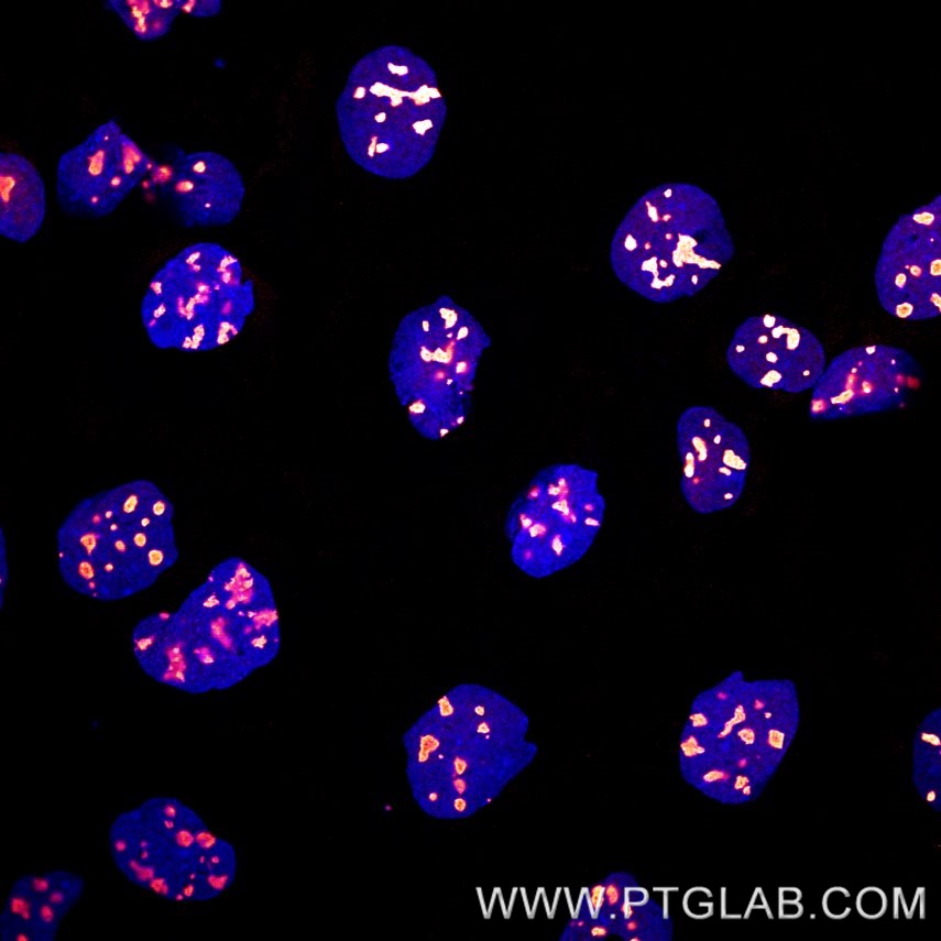 Immunofluorescence of A431 cells: PFA-fixed cells were stained with anti-B23 (60096-1-lg) labeled with FlexAble CoraLite® Plus 594 Kit (KFA029, orange) and DAPI (blue). ​

Confocal images were acquired with a 63x oil objective and post-processed. Images were recorded at the Core Facility Bioimaging at the Biomedical Center, LMU Munich.