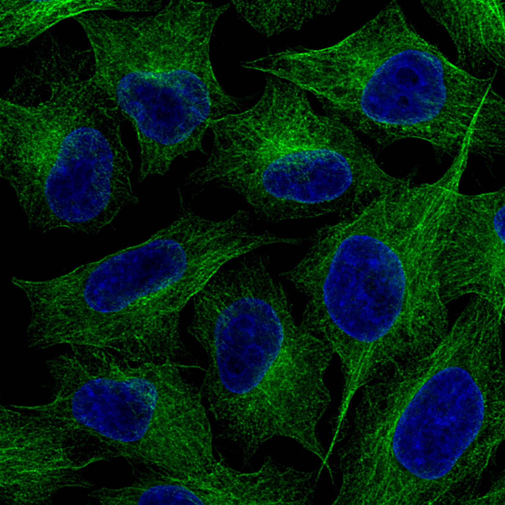 Immunofluorescence of HeLa: PFA-fixed HeLa cells were stained with anti-Tubulin (66240-1-Ig) labeled with FlexAble CoraLite® Plus 488 Kit (KFA041, green). Cell nuclei are in blue.
Confocal images were acquired with a 100x oil objective and post-processed. Images were recorded at the Core Facility Bioimaging at the Biomedical Center, LMU Munich.