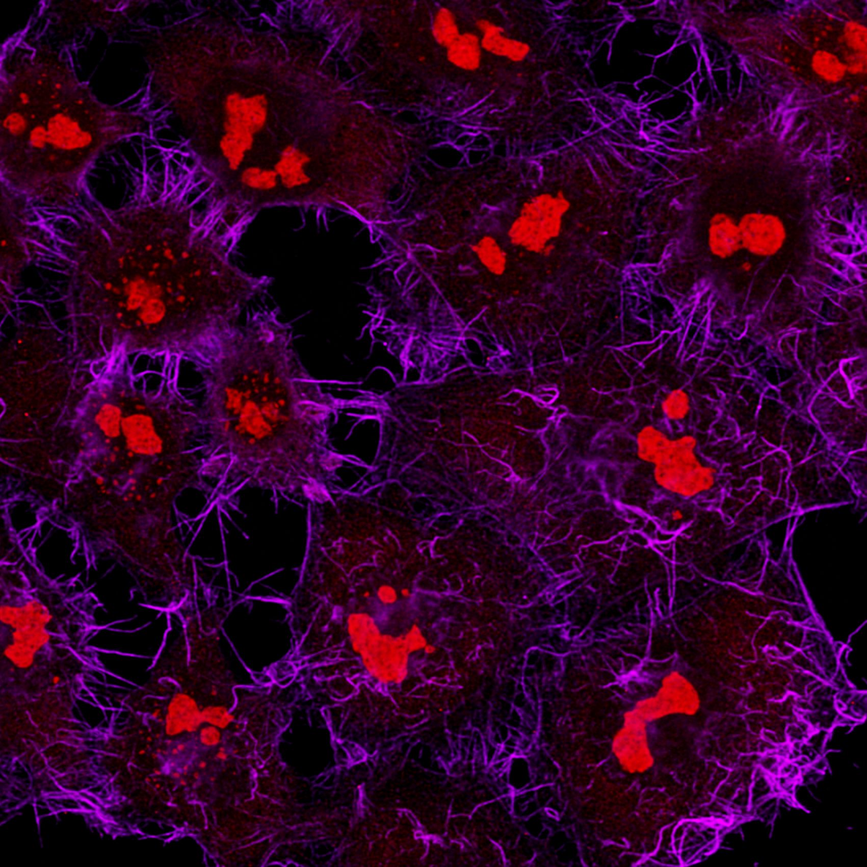 Immunofluorescence of HeLa: PFA-fixed HeLa cells were stained with anti-GNL3 (67169-1-lg) labeled with FlexAble CoraLite® Plus 555 Kit (KFA042, red) and anti-Actin labeled with FlexAble CoraLite® Plus 647 Kit (KFA043, magenta).
Confocal images were acquired with a 100x oil objective and post-processed. Images were recorded at the Core Facility Bioimaging at the Biomedical Center, LMU Munich.