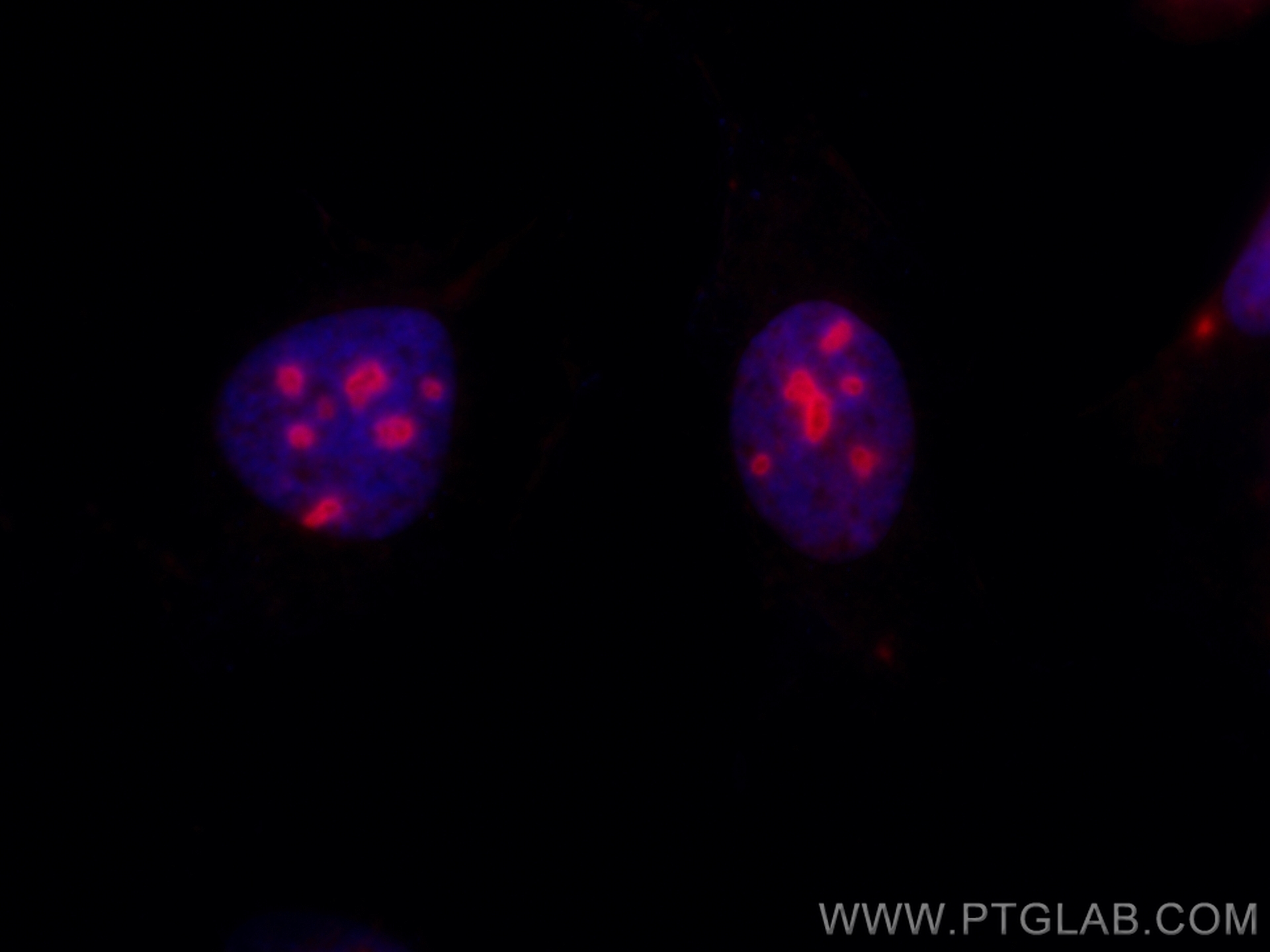 Immunofluorescence of HeLa: PFA-fixed HeLa cells were stained with anti-GNL3 antibody (67169-1-Ig) labeled with FlexAble HRP Antibody Labeling Kit for Mouse IgG2a (KFA045) and Tyramide-594 (red). Cell nuclei are in blue.