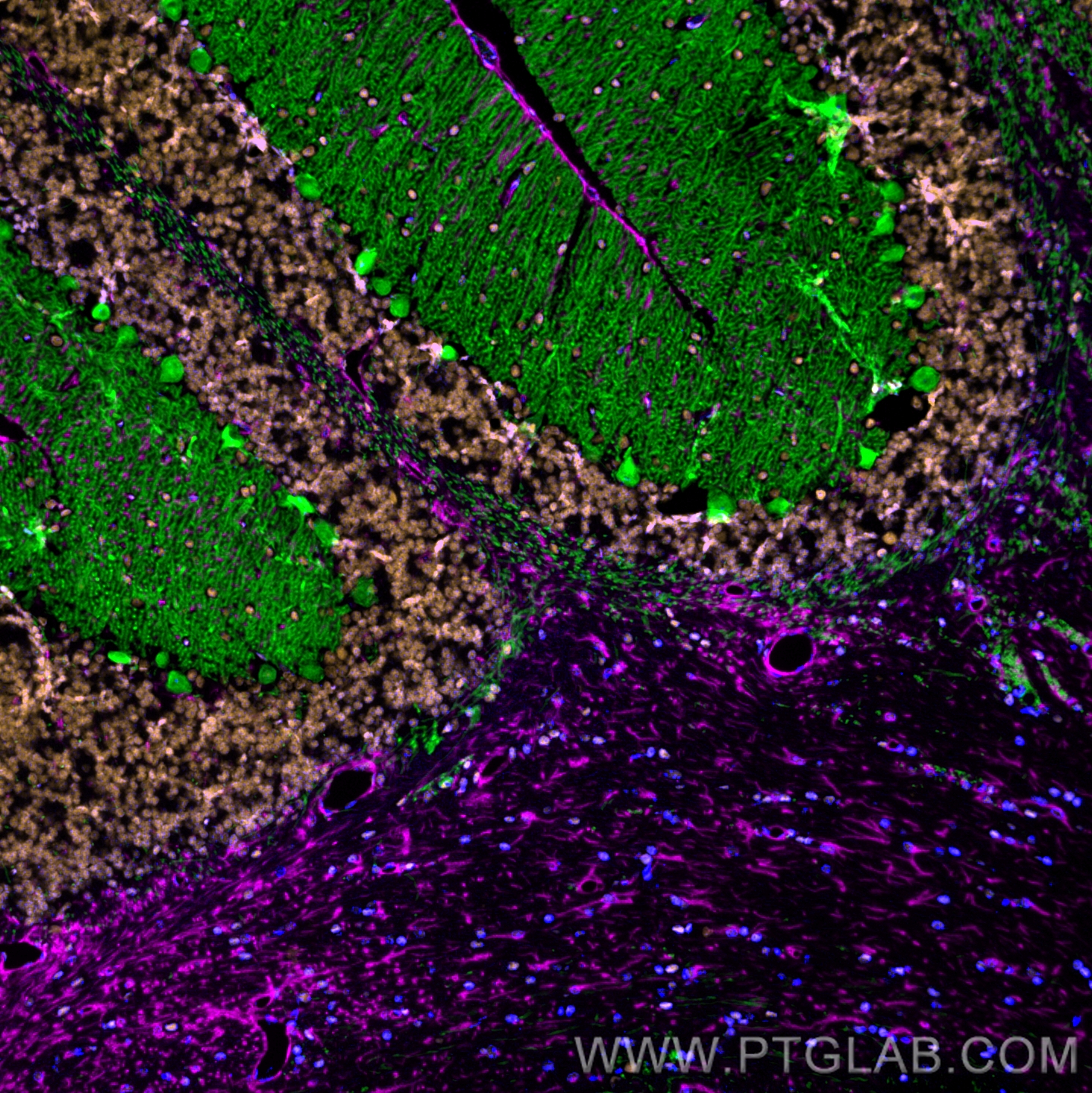 Immunofluorescence of mouse cerebellum: FFPE mouse cerebellum sections were stained with anti-Calbindin antibody (14479-1-AP, green) labeled with FlexAble HRP Antibody Labeling Kit for Rabbit IgG (KFA005) and Tyramide-488, anti-FUS antibody (68262-1-Ig, orange) labeled with FlexAble HRP Antibody Labeling Kit for Mouse IgG1 (KFA025) and Tyramide-555, and anti-GFAP antibody (60190-1-Ig, magenta) labeled with FlexAble HRP Antibody Labeling Kit for Mouse IgG2a (KFA045) and Tyramide-650. Cell nuclei are in blue.