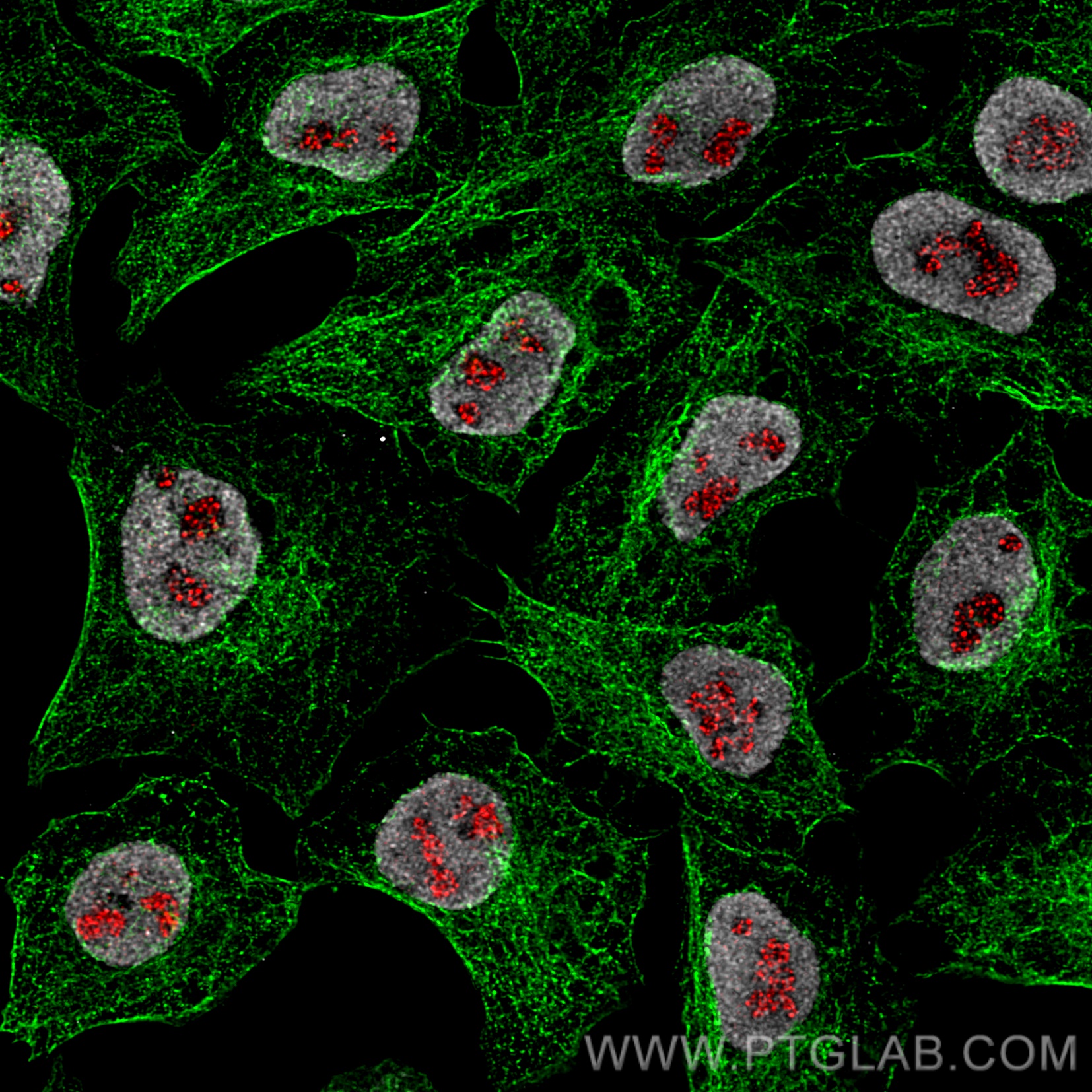 Immunofluorescence of HeLa: PFA-fixed HeLa cells were stained with anti-Tubulin antibody labeled with FlexAble CoraLite® Plus 488 Kit (KFA061, green), mouse IgG2b anti-PAF49 primary and anti-mouse IgG secondary antibody Alexa Fluor® 568 (red) and CoraLite® 647-conjugated HDAC2 antibody (CL647-67615, grey). Confocal images were acquired with a 100x oil objective and post-processed. Images were recorded at the Core Facility Bioimaging at the Biomedical Center, LMU Munich.