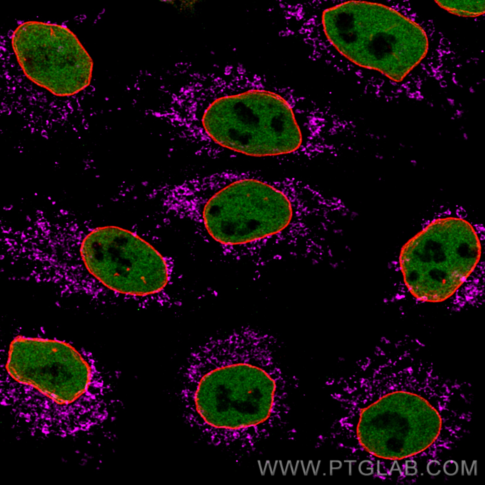 Immunofluorescence of HeLa: PFA-fixed HeLa cells were stained with anti-HDAC2 (67165-1-Ig) labeled with FlexAble CoraLite® Plus 488 Kit (KFA061, green), mouse IgG2b anti-Lamin primary and anti-mouse IgG secondary antibody Alexa Fluor® 568 (red) and anti-Tom20 (66777-1-Ig) labeled with FlexAble ​CoraLite® Plus 647 Kit (KFA063, magenta). Confocal images were acquired with a 100x oil objective and post-processed. Images were recorded at the Core Facility Bioimaging at the Biomedical Center, LMU Munich.