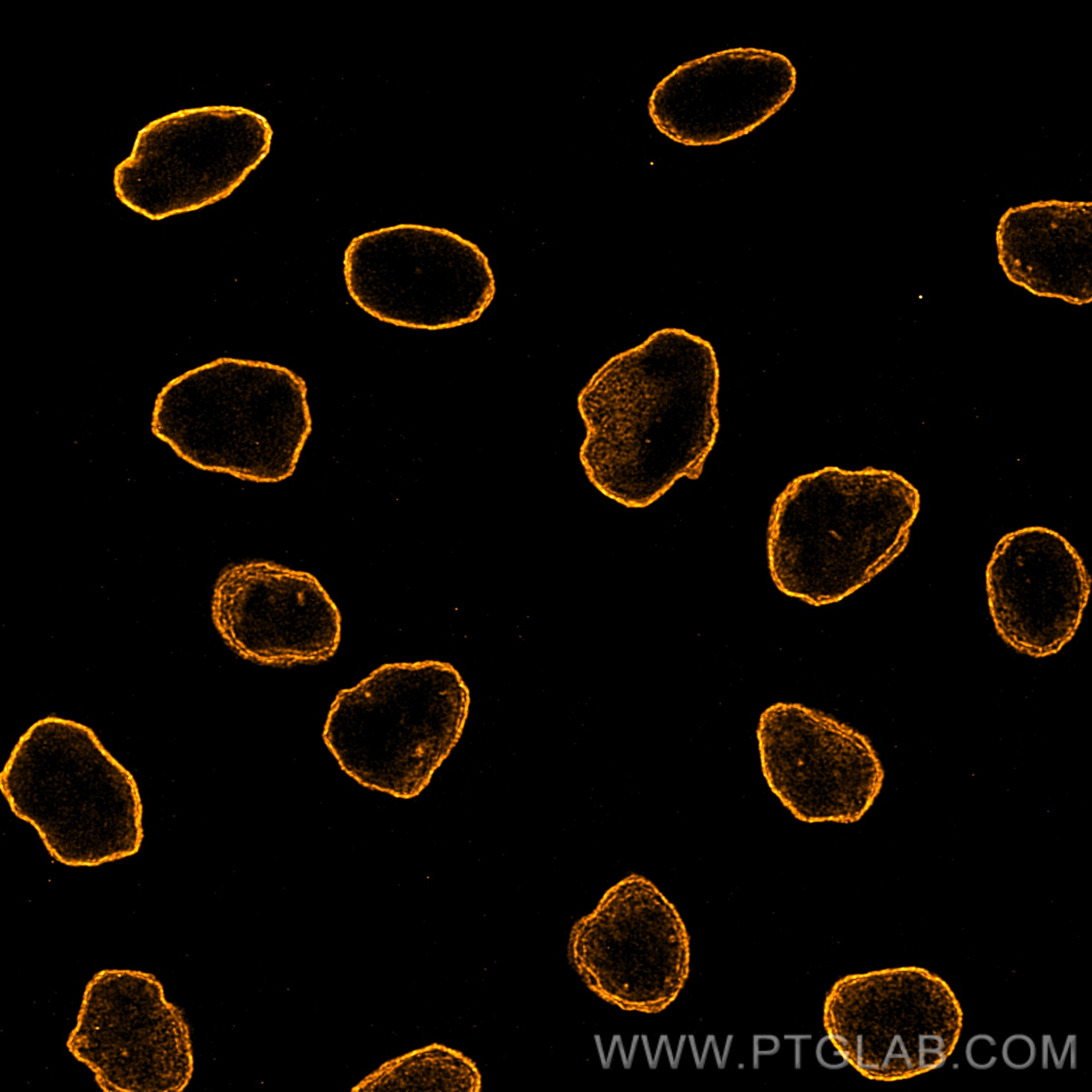 Immunofluorescence of HeLa: PFA-fixed HeLa cells were stained with anti-Lamin antibody labeled with FlexAble CoraLite® Plus 555 Kit (KFA062, orange). Confocal images were acquired with a 100x oil objective and post-processed. Images were recorded at the Core Facility Bioimaging at the Biomedical Center, LMU Munich.