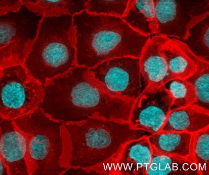 Live A431 cells were immunostained with anti-EGFR (cetuximab biosimilar) and FlexAble CoraLite® Plus 594 Kit (KFA112, red). Nuclei are in cyan.
This epifluorescence image was acquired at Zeiss Demo Center, Munich, with a 40x objective and post-processed.