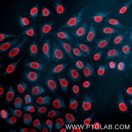 HeLa cells were immunostained with rabbit IgG anti-TOM70 antibody (cat# 14528-1-AP), labeled with FlexAble 2.0 CoraLite® Plus 405 Kit (KFA506, cyan). Cell nuclei are in red. Epifluorescence images were acquired with a 20x objective and post-processed.