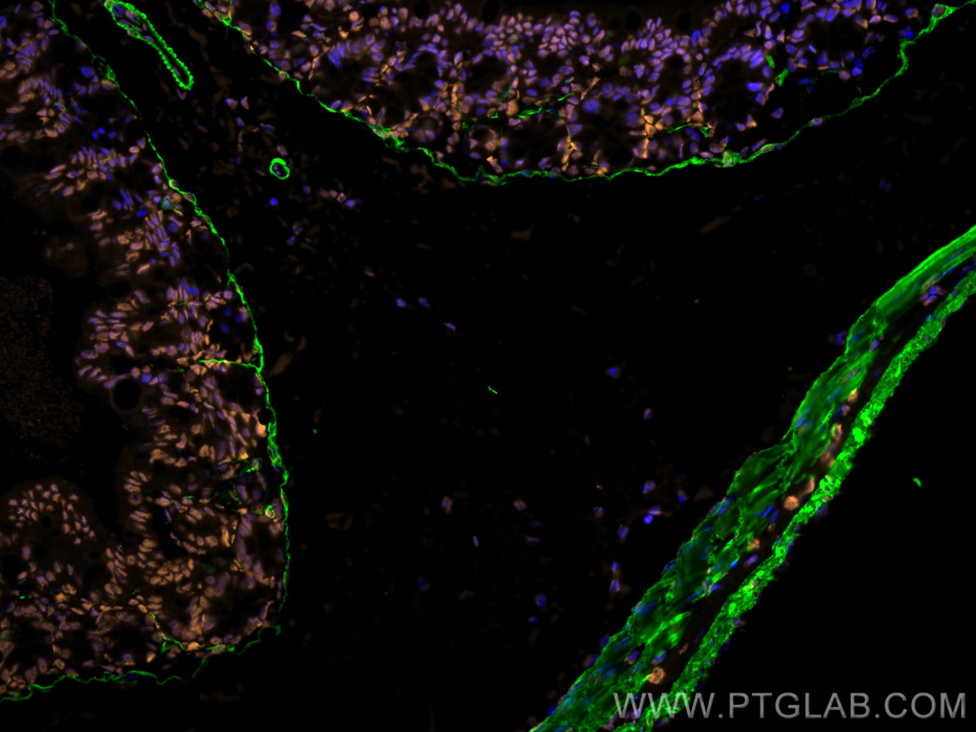 Immunofluorescence of Mouse colon: FFPE Mouse colon sections were stained with anti-FUS (11570-1-AP) labeled with FlexAble 2.0 CoraLite® Plus 555 Kit (KFA502, orange), anti-α-SMA (67735-1-Ig) labeled with FlexAble 2.0 CoraLite® Plus 488 Kit (KFA521, green) and DAPI (blue).