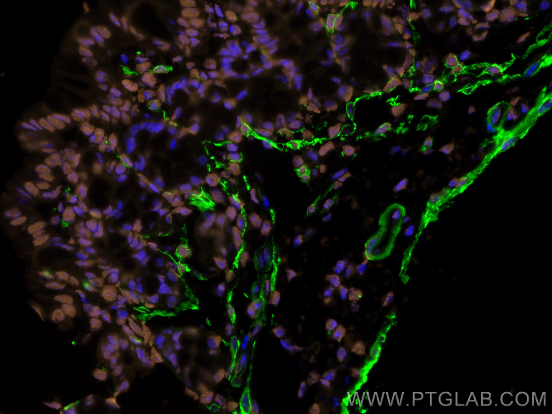 Immunofluorescence of Mouse colon: FFPE Mouse colon sections were stained with anti-FUS (11570-1-AP) labeled with FlexAble 2.0 CoraLite® Plus 555 Kit (KFA502, orange), anti-α-SMA (67735-1-Ig) labeled with FlexAble 2.0 CoraLite® Plus 488 Kit (KFA521, green) and DAPI (blue).