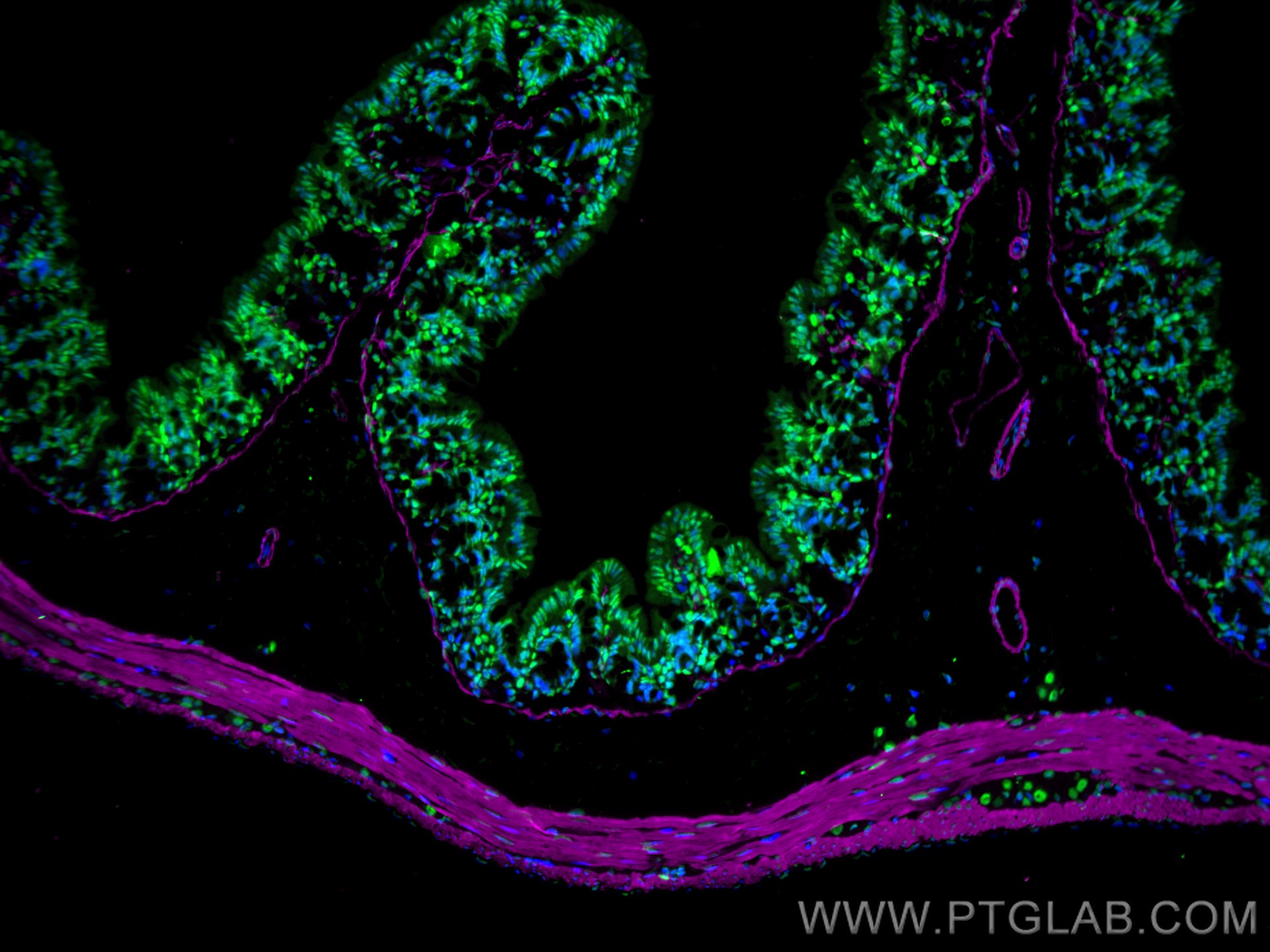 Immunofluorescence of Mouse colon: FFPE Mouse colon sections were stained with anti-FUS (11570-1-AP) labeled with FlexAble 2.0 CoraLite® Plus 488 Kit (KFA501, green), anti-α-SMA (67735-1-Ig) labeled with FlexAble 2.0 CoraLite® Plus 647 Kit (KFA523, magenta) and DAPI (blue).
