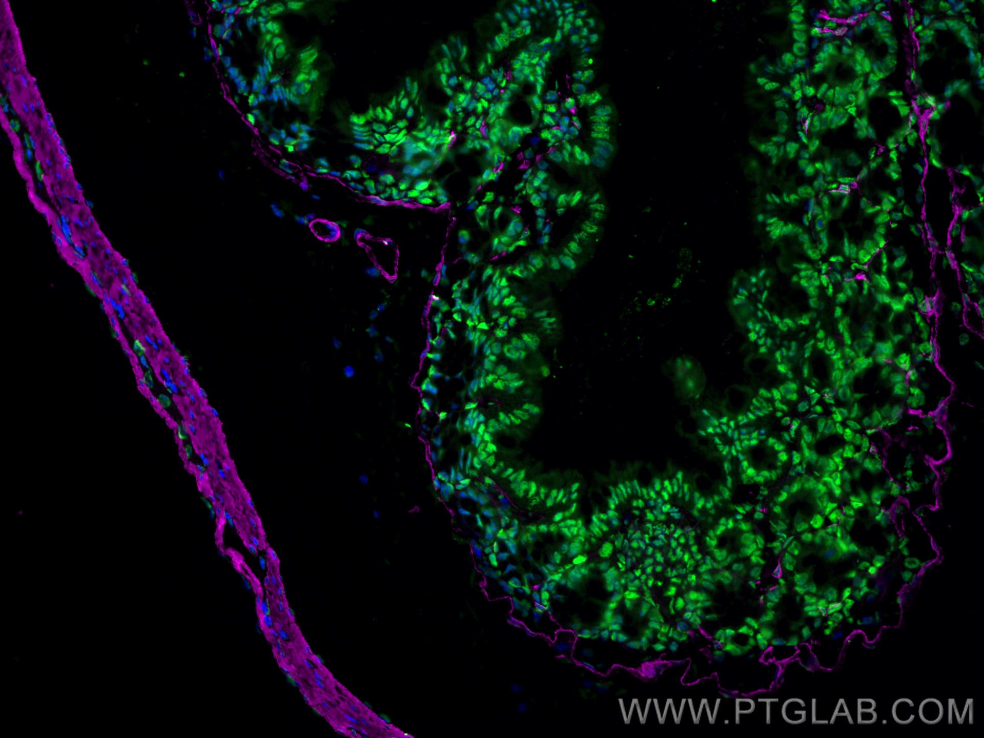 Immunofluorescence of Mouse colon: FFPE Mouse colon sections were stained with anti-FUS (11570-1-AP) labeled with FlexAble 2.0 CoraLite® Plus 488 Kit (KFA501, green), anti-α-SMA (67735-1-Ig) labeled with FlexAble 2.0 CoraLite® Plus 647 Kit (KFA523, magenta) and DAPI (blue).
