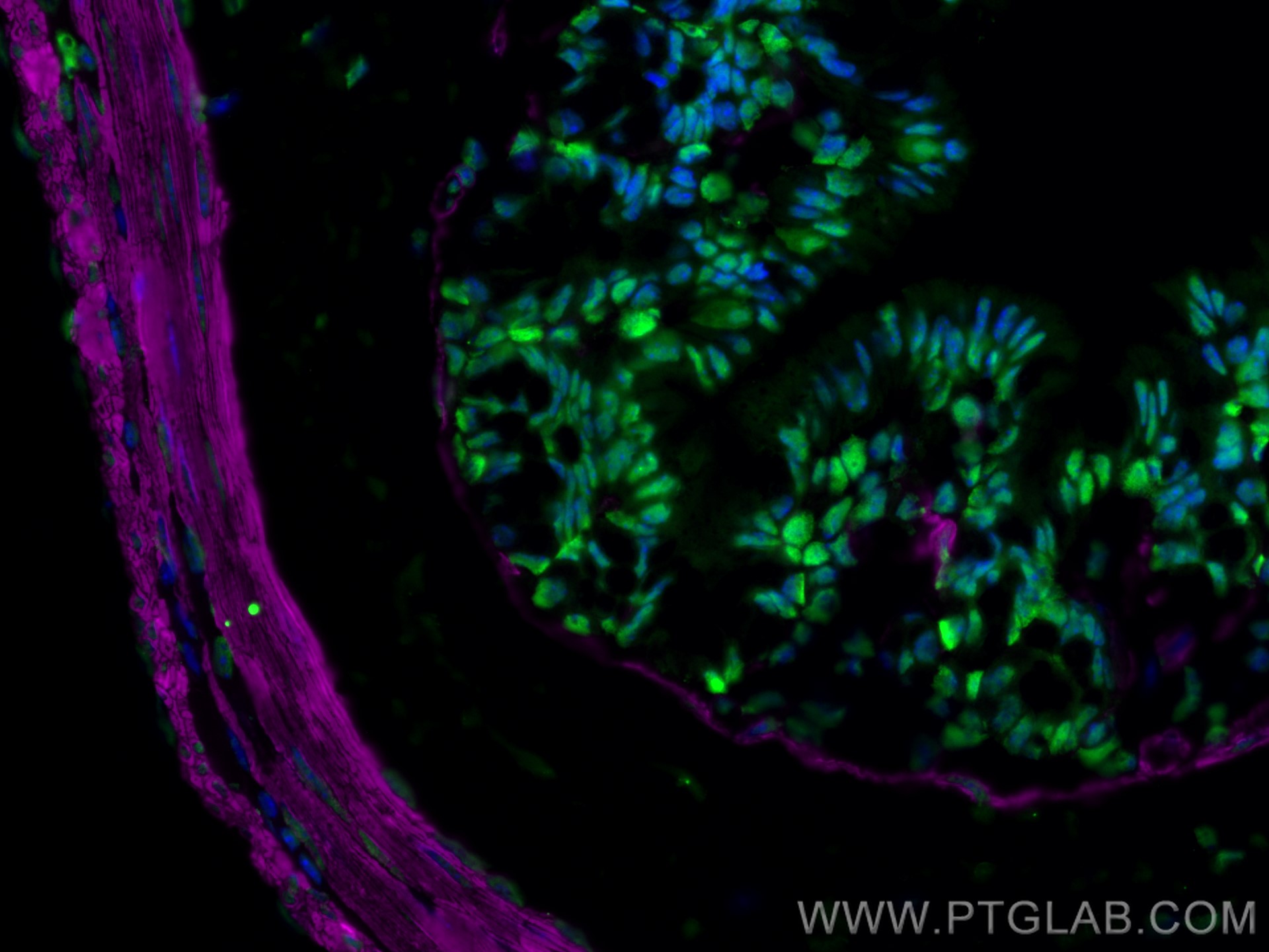 Immunofluorescence of Mouse colon: FFPE Mouse colon sections were stained with anti-FUS (11570-1-AP) labeled with FlexAble 2.0 CoraLite® Plus 488 Kit (KFA501, green), anti-α-SMA (67735-1-Ig) labeled with FlexAble 2.0 CoraLite® Plus 647 Kit (KFA523, magenta) and DAPI (blue).
