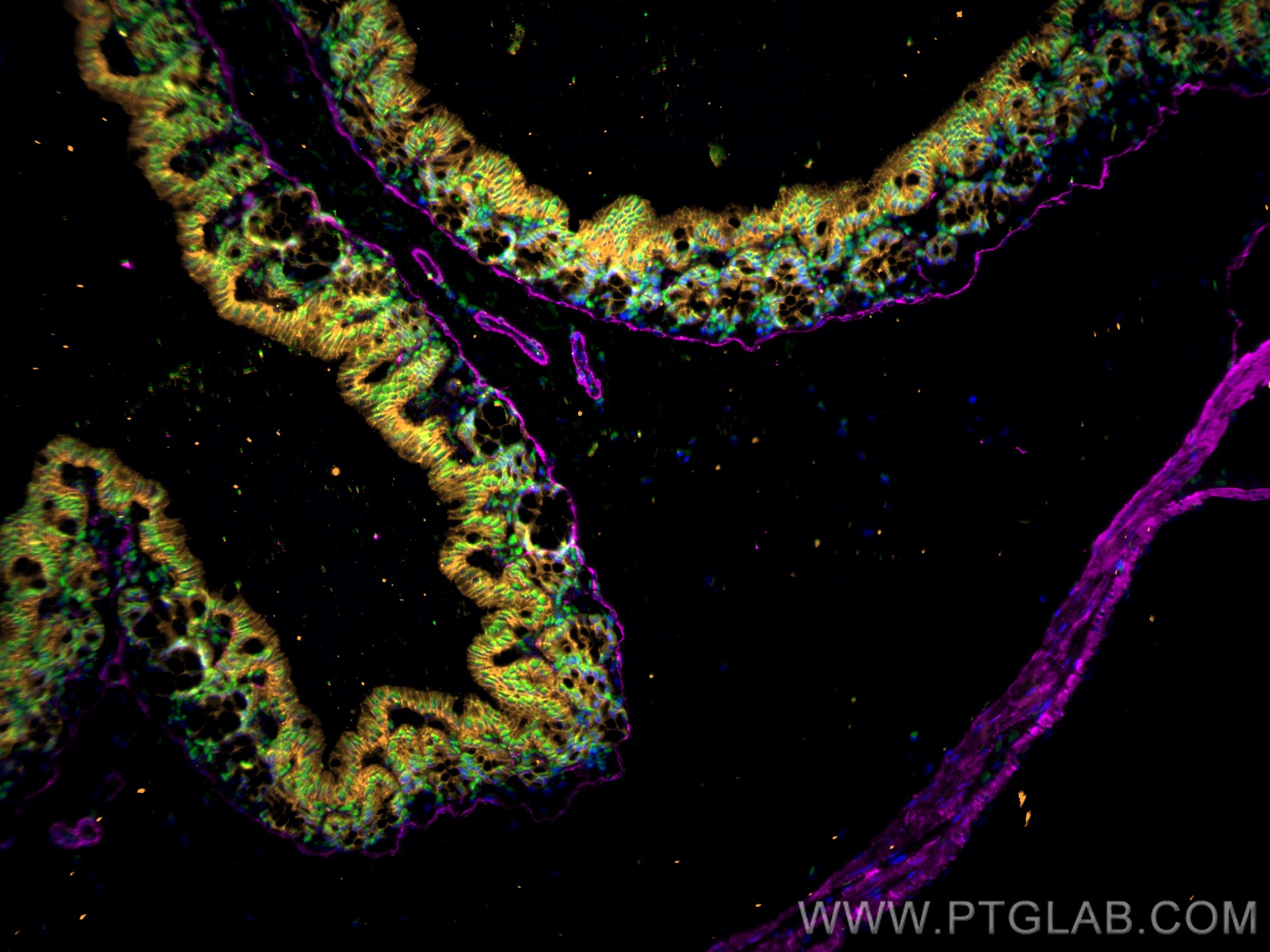 Immunofluorescence of Mouse colon: FFPE Mouse colon sections were stained with anti-FUS (11570-1-AP) labeled with FlexAble 2.0 CoraLite® Plus 488 Kit (KFA501, green), anti-α-SMA (67735-1-Ig) labeled with FlexAble 2.0 CoraLite® Plus 647 Kit (KFA523, magenta),anti-E-cadherin (60335-1-Ig) labeled with FlexAble 2.0 CoraLite® Plus 555 Kit (KFA562, orange) and DAPI (blue).