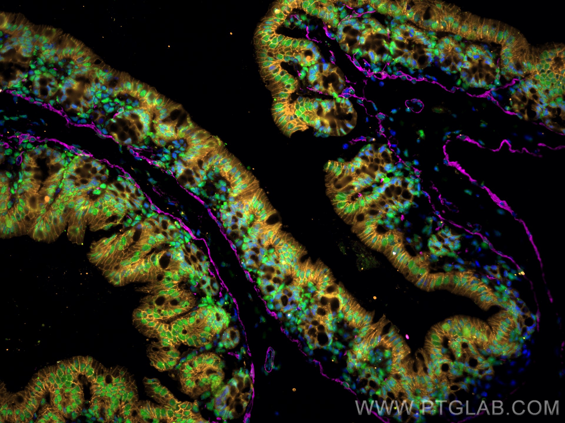 Immunofluorescence of Mouse colon: FFPE Mouse colon sections were stained with anti-FUS (11570-1-AP) labeled with FlexAble 2.0 CoraLite® Plus 488 Kit (KFA501, green), anti-α-SMA (67735-1-Ig) labeled with FlexAble 2.0 CoraLite® Plus 647 Kit (KFA523, magenta),anti-E-cadherin (60335-1-Ig) labeled with FlexAble 2.0 CoraLite® Plus 555 Kit (KFA562, orange) and DAPI (blue).