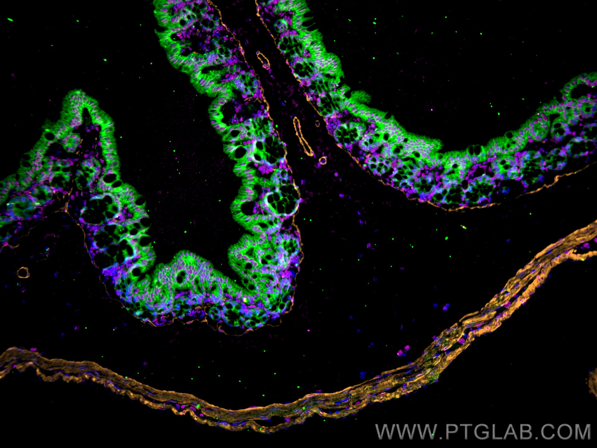 Immunofluorescence of Mouse colon: FFPE Mouse colon sections were stained with anti-FUS (11570-1-AP) labeled with FlexAble 2.0 CoraLite® Plus 647 Kit (KFA503, magenta), anti-α-SMA (67735-1-Ig) labeled with FlexAble 2.0 CoraLite® Plus 555 Kit (KFA522, orange), anti-E-cadherin (60335-1-Ig) labeled with FlexAble 2.0 CoraLite® Plus 488 Kit (KFA561, green) and DAPI (blue).