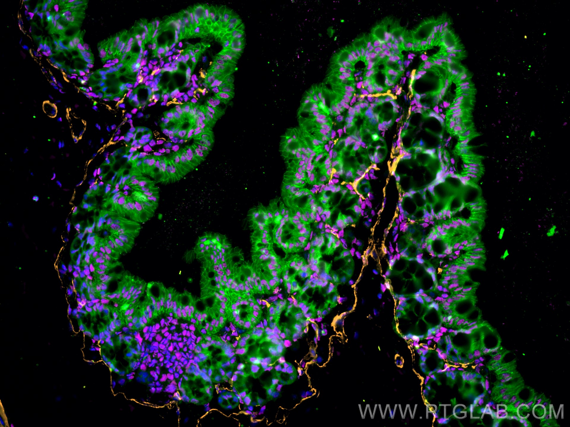 Immunofluorescence of Mouse colon: FFPE Mouse colon sections were stained with anti-FUS (11570-1-AP) labeled with FlexAble 2.0 CoraLite® Plus 647 Kit (KFA503, magenta), anti-α-SMA (67735-1-Ig) labeled with FlexAble 2.0 CoraLite® Plus 555 Kit (KFA522, orange), anti-E-cadherin (60335-1-Ig) labeled with FlexAble 2.0 CoraLite® Plus 488 Kit (KFA561, green) and DAPI (blue).