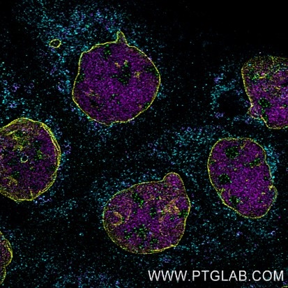 Immunofluorescence of A431 cells: PFA-fixed cells were stained with mouse IgG2b anti-PAF49 antibody labeled with FlexAble 2.0 CoraLite® Plus 488 Kit (KFA561, green), mouse IgG2b anti-Lamin antibody labeled with FlexAble 2.0 CoraLite® Plus 555 Kit (KFA562, yellow), mouse IgG2b anti-HDAC2 antibody (67165-1-Ig) labeled with FlexAble 2.0 CoraLite® Plus 647 Kit (KFA563, magenta) and mouse IgG2b anti-Tom20 antibody (66777-1-Ig) labeled with FlexAble 2.0 CoraLite® Plus 750 Kit (KFA564, cyan).

Confocal images were acquired with a 63x oil objective and post-processed. Images were recorded at the Core Facility Bioimaging at the Biomedical Center, LMU Munich.