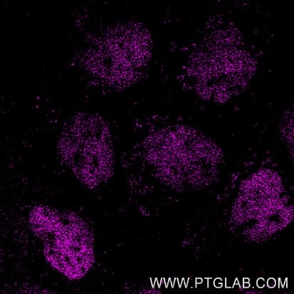 Immunofluorescence of A431 cells: PFA-fixed cells were stained with mouse IgG2b anti-HDAC2 antibody (67165-1-Ig) labeled with FlexAble 2.0 CoraLite® Plus 647 Kit (KFA563, magenta).

Confocal images were acquired with a 63x oil objective and post-processed. Images were recorded at the Core Facility Bioimaging at the Biomedical Center, LMU Munich.