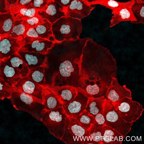 A431 cells were immunostained with human IgG1 anti-EGFR antibody (cetuximab biosimilar) labeled with FlexAble 2.0 CoraLite® Plus 555 kit (KFA605).  Nuclei are in cyan.