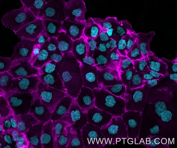 A431 cells were immunostained with human IgG1 anti-EGFR antibody (cetuximab biosimilar) labeled with FlexAble 2.0 CoraLite® Plus 647 kit (KFA606).  Nuclei are in cyan.