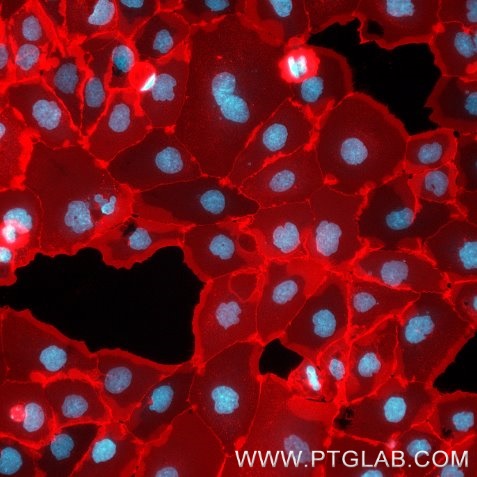 A431 cells were immunostained with human IgG anti-EGFR antibody (Cetuximab biosimilar), labeled with FlexAble 2.0 CoraLite® Plus 594 Kit (KFA612, red). Cell nuclei are in cyan. Epifluorescence images were acquired with a 20x objective and post-processed.