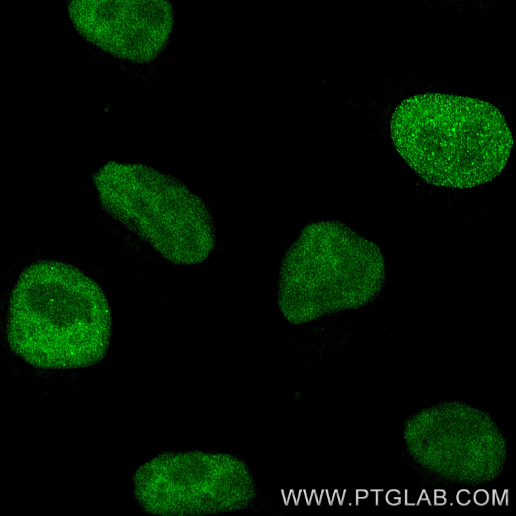 PFA-fixed and permeabilized HeLa cells were stained with rat anti-RPA32 antibody labeled with FlexAble 2.0 CoraLite® Plus 488 Kit (KFA621, green). Confocal images were acquired with a 63x oil objective and post-processed.