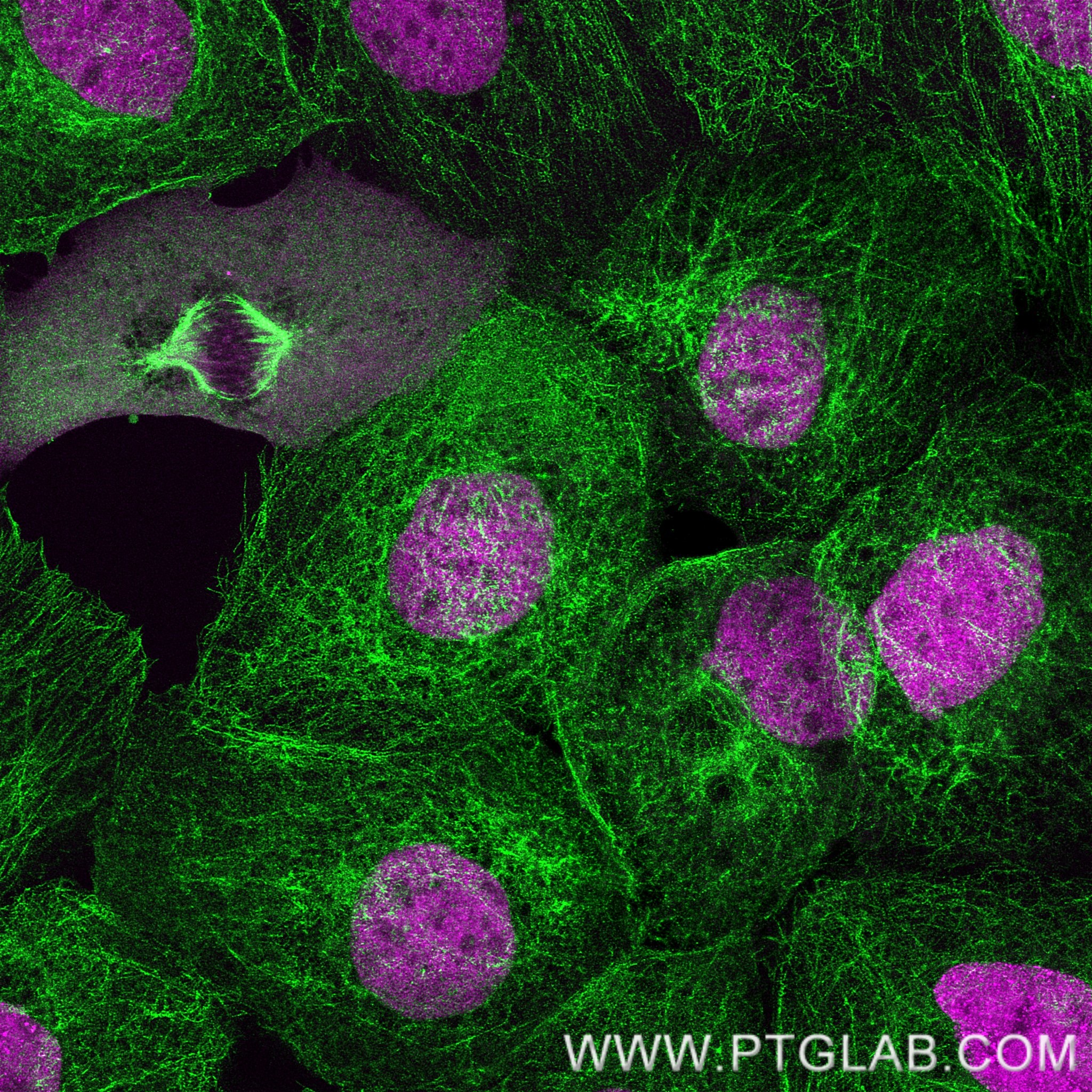 PFA-fixed and permeabilized A431 cells were co-stained with rat anti-Tubulin antibody labeled with FlexAble 2.0 CoraLite® Plus 488 Kit (KFA621, green) and rat anti-RPA32 antibody labeled with FlexAble 2.0 CoraLite® Plus 555 Kit (KFA622, magenta). Confocal images were acquired with a 63x oil objective and post-processed.