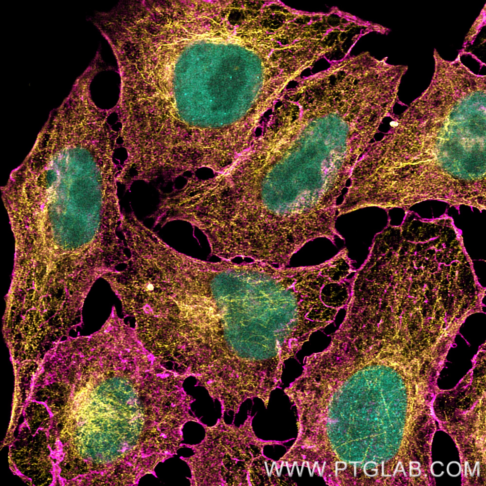 PFA-fixed and permeabilized HeLa cells were co-stained with rat anti-RPA32 antibody labeled with FlexAble 2.0 CoraLite® Plus 488 Kit (KFA621, cyan), rat anti-Tubulin antibody labeled with FlexAble 2.0 CoraLite® Plus 555 Kit (KFA622, orange) and  rat anti-CD44 antibody (65117-1-Ig) labeled with FlexAble 2.0 CoraLite® Plus 647 Kit (KFA623, magenta). Confocal images were acquired with a 63x oil objective and post-processed.