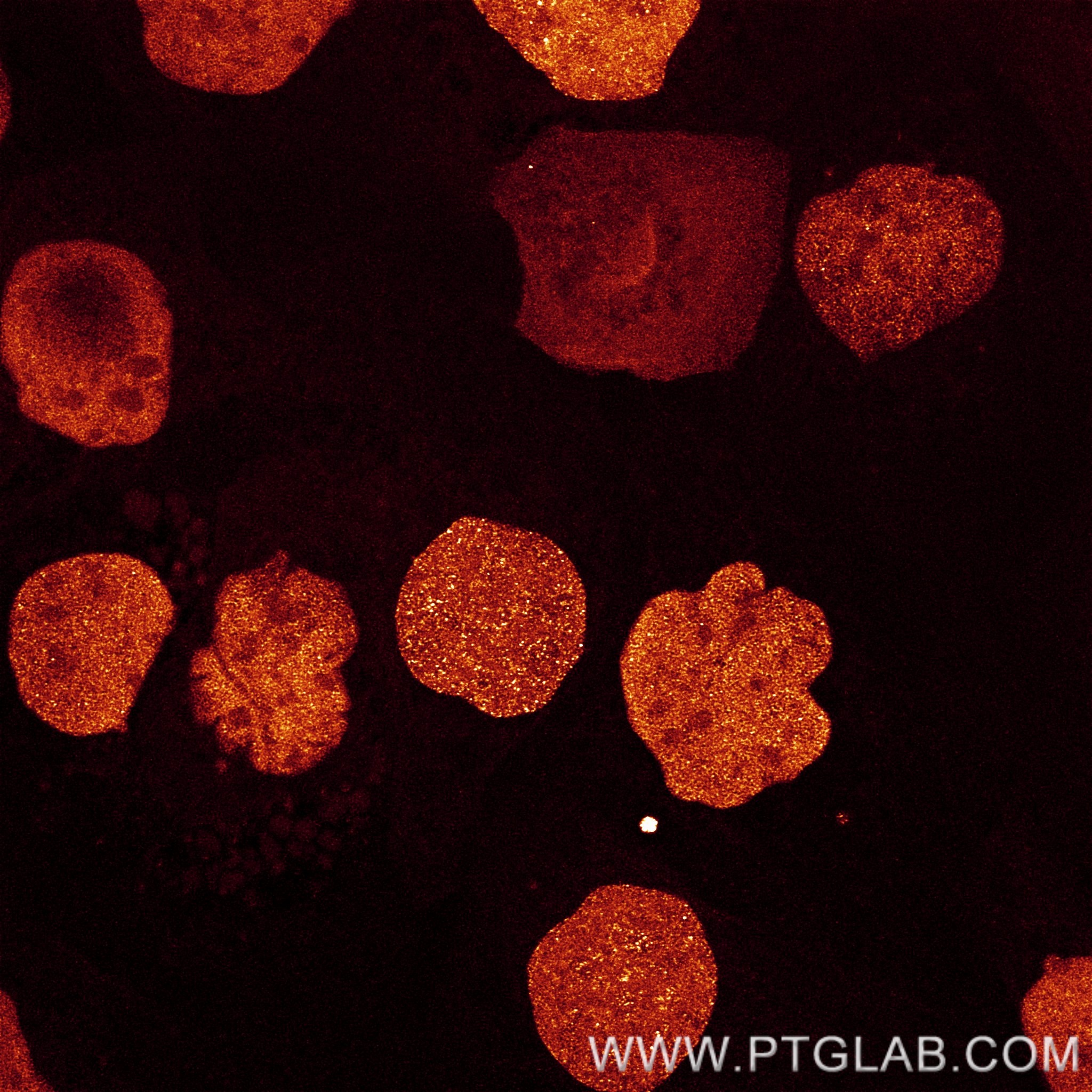 PFA-fixed and permeabilized A431 cells were stained with rat anti-RPA32 antibody labeled with FlexAble 2.0 CoraLite® Plus 555 Kit (KFA622, orange glow). Confocal images were acquired with a 63x oil objective and post-processed.