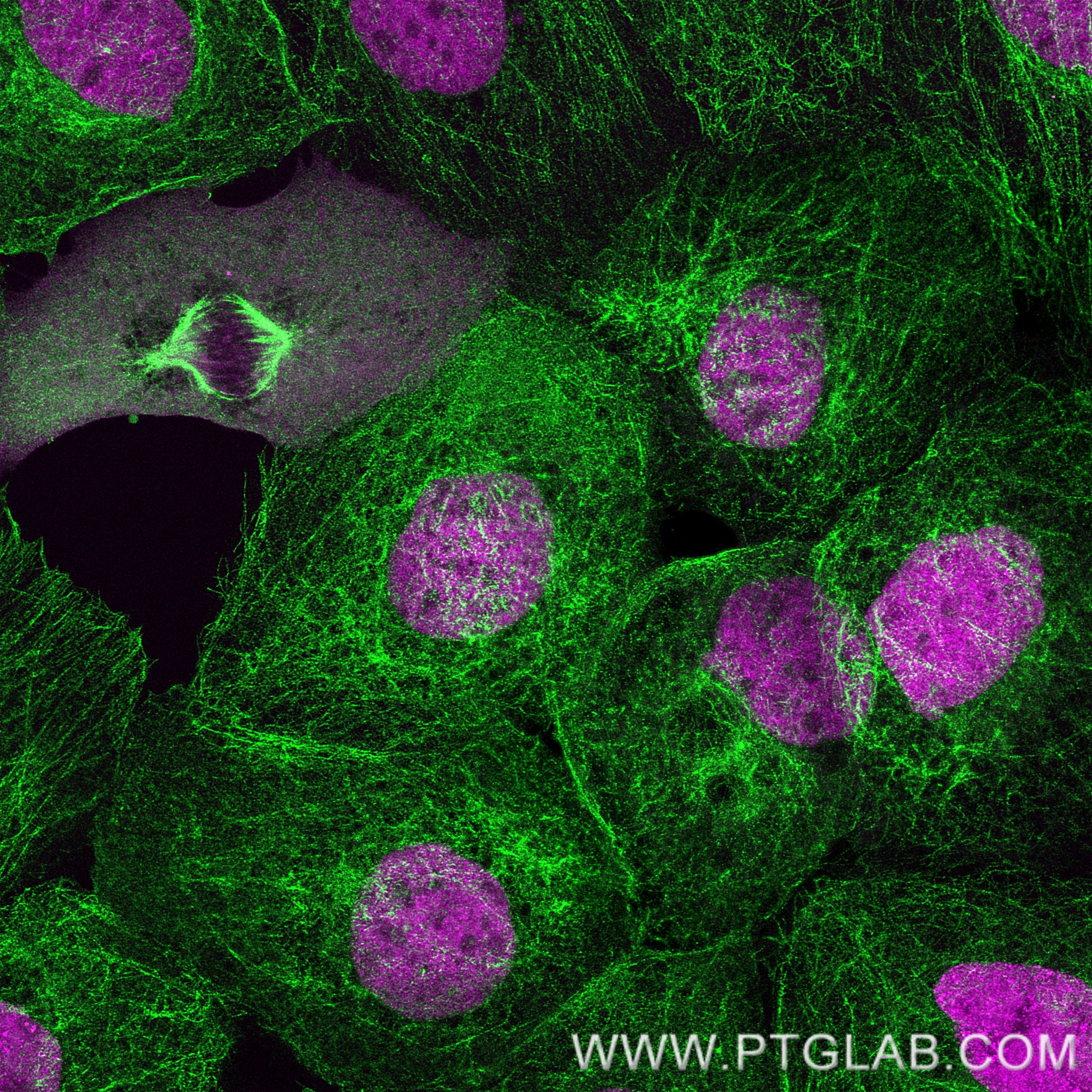 PFA-fixed and permeabilized A431 cells were co-stained with rat anti-Tubulin antibody labeled with FlexAble 2.0 CoraLite® Plus 488 Kit (KFA621, green) and rat anti-RPA32 antibody labeled with FlexAble 2.0 CoraLite® Plus 555 Kit (KFA622, magenta). Confocal images were acquired with a 63x oil objective and post-processed.