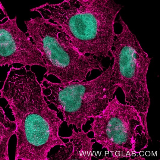 PFA-fixed HeLa cells were stained with rat anti-CD44 antibody (65117-1-Ig) labeled with FlexAble 2.0 CoraLite® Plus 647 Kit (KFA623, magenta). Nuclei are in cyan. Confocal images were acquired with a 63x oil objective and post-processed.