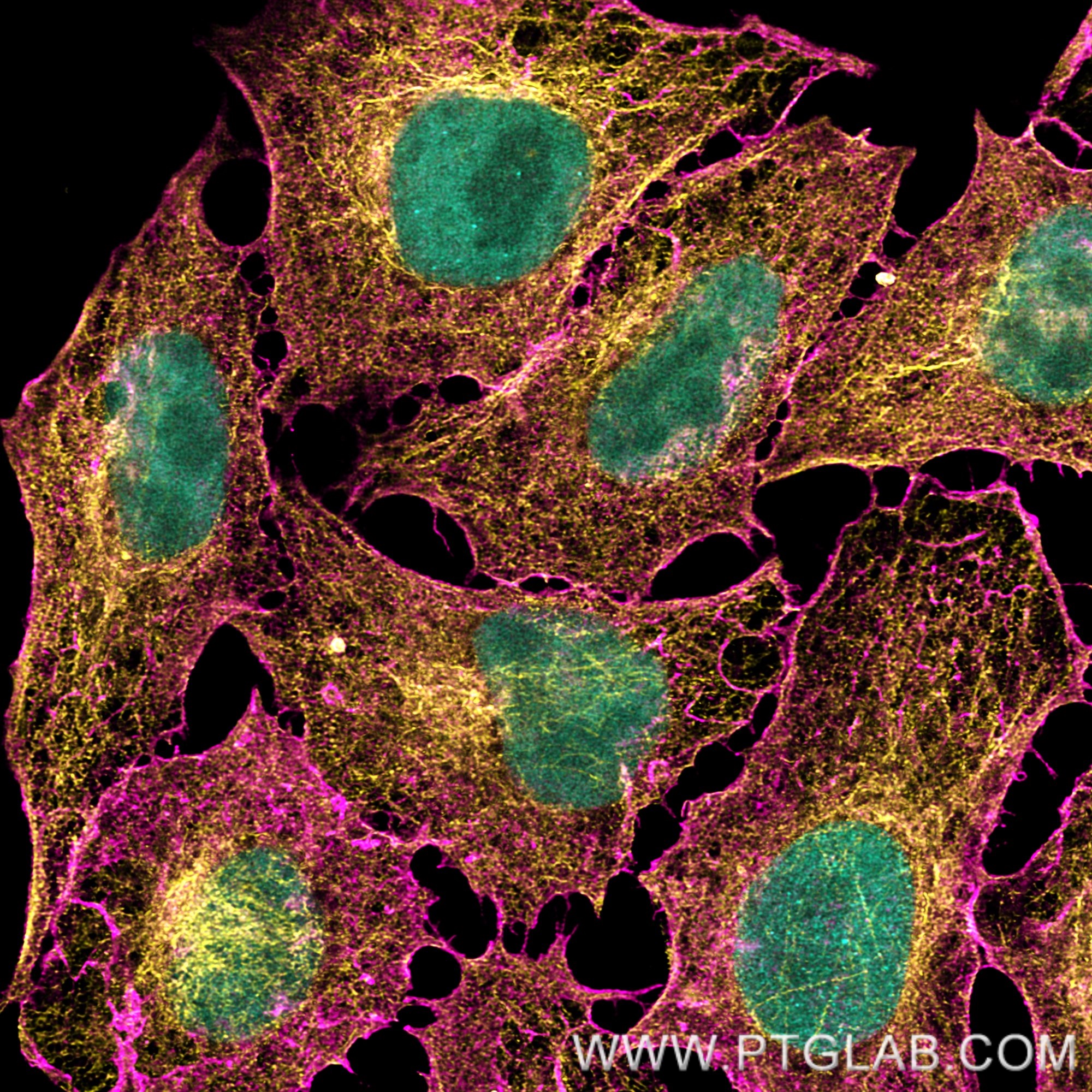 PFA-fixed and permeabilized HeLa cells were co-stained with rat anti-RPA32 antibody labeled with FlexAble 2.0 CoraLite® Plus 488 Kit (KFA621, cyan), rat anti-Tubulin antibody labeled with FlexAble 2.0 CoraLite® Plus 555 Kit (KFA622, orange) and  rat anti-CD44 antibody (65117-1-Ig) labeled with FlexAble 2.0 CoraLite® Plus 647 Kit (KFA623, magenta). Confocal images were acquired with a 63x oil objective and post-processed. 
