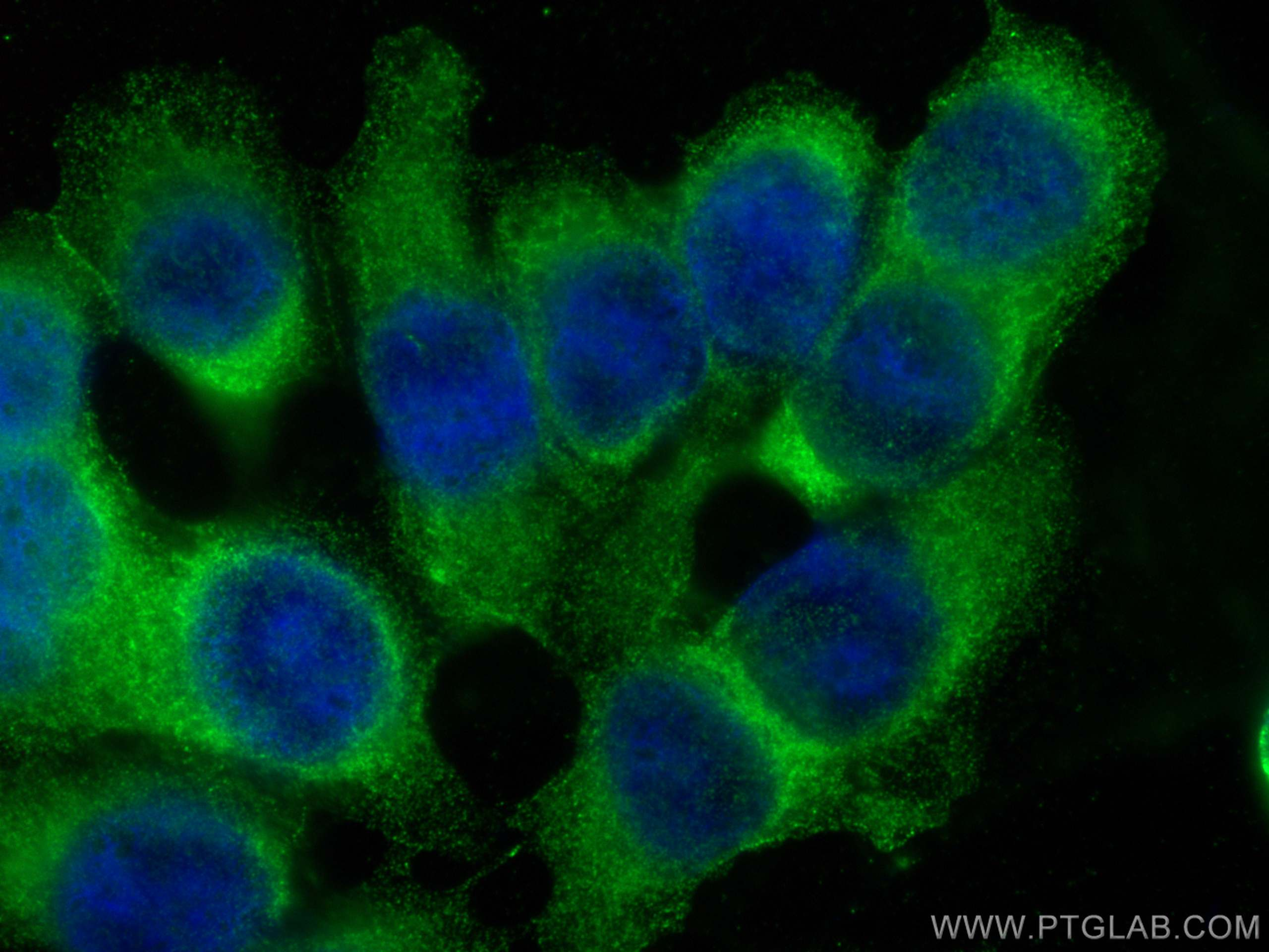 Immunofluorescent analysis of (-20°C Methanol) fixed MCF-7 cells using AKT antibody (60203-2-Ig, Clone: 2C5D1 ) at dilution of 1:400 and CoraLite®488-Conjugated AffiniPure Goat Anti-Mouse IgG(H+L).