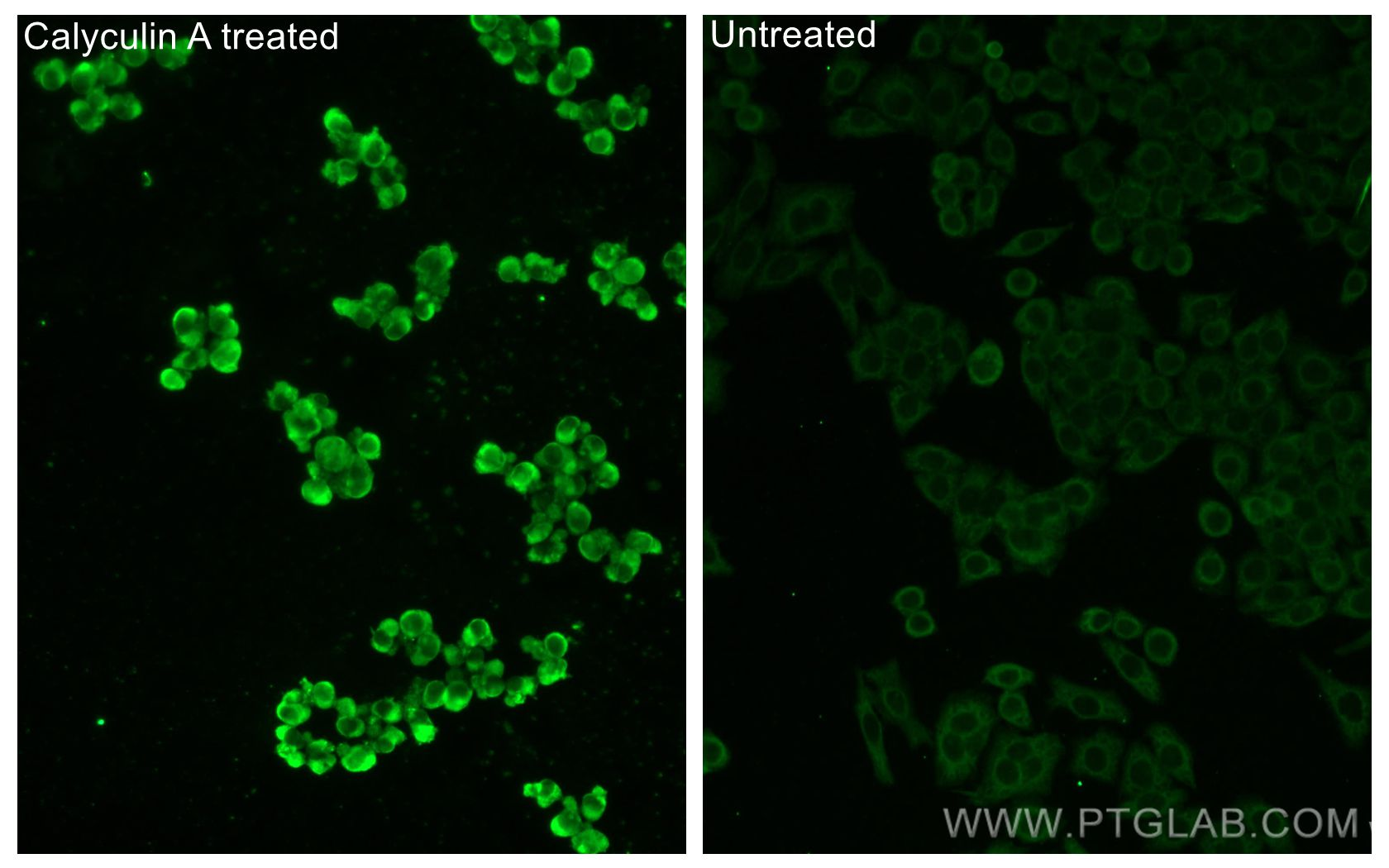 Immunofluorescent analysis of (-20°C Ethanol) fixed Calyculin A treated PC-3 cells and non-treated PC-3 cells using Phospho-GSK3B (Ser9) antibody (67558-1-Ig, Clone: 1C9E2 ) at dilution of 1:200 and CoraLite®488-Conjugated AffiniPure Goat Anti-Mouse IgG(H+L).