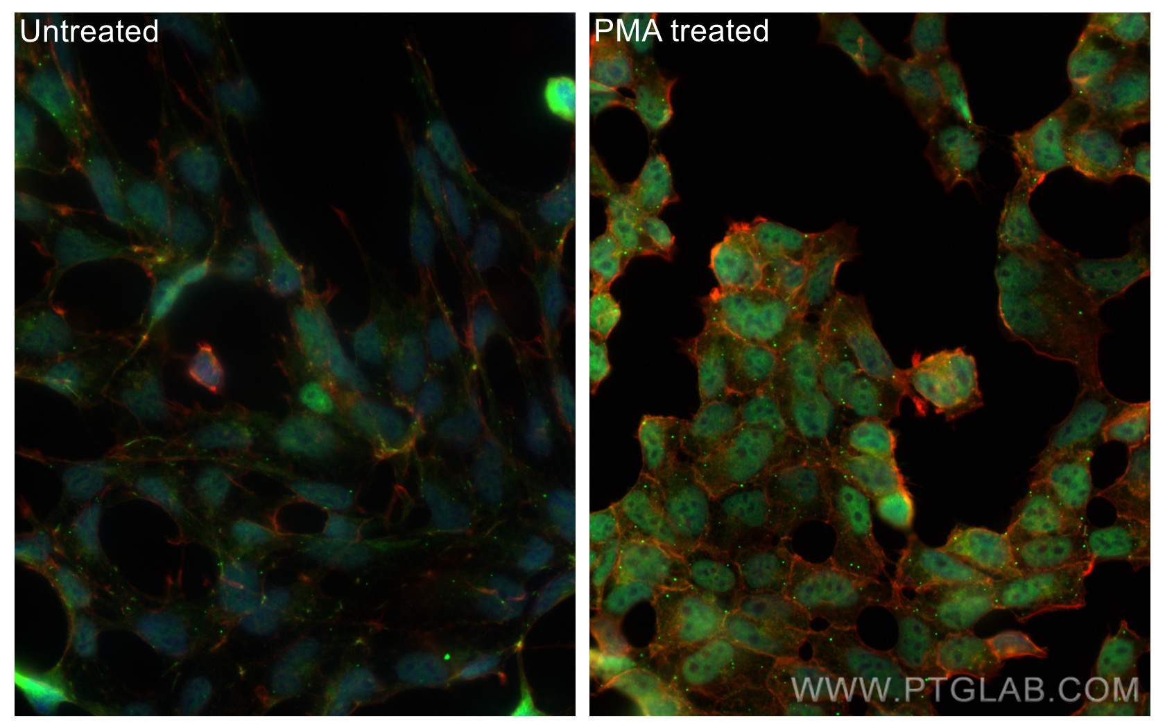 Immunofluorescent analysis of (4% PFA) fixed PMA treated HEK-293 cells using Phospho-mTOR (Ser2448) antibody (80596-1-RR, Clone: 3L18 ) at dilution of 1:1000 and CoraLite®488-Conjugated AffiniPure Goat Anti-Rabbit IgG(H+L), CL594-phalloidin (red).