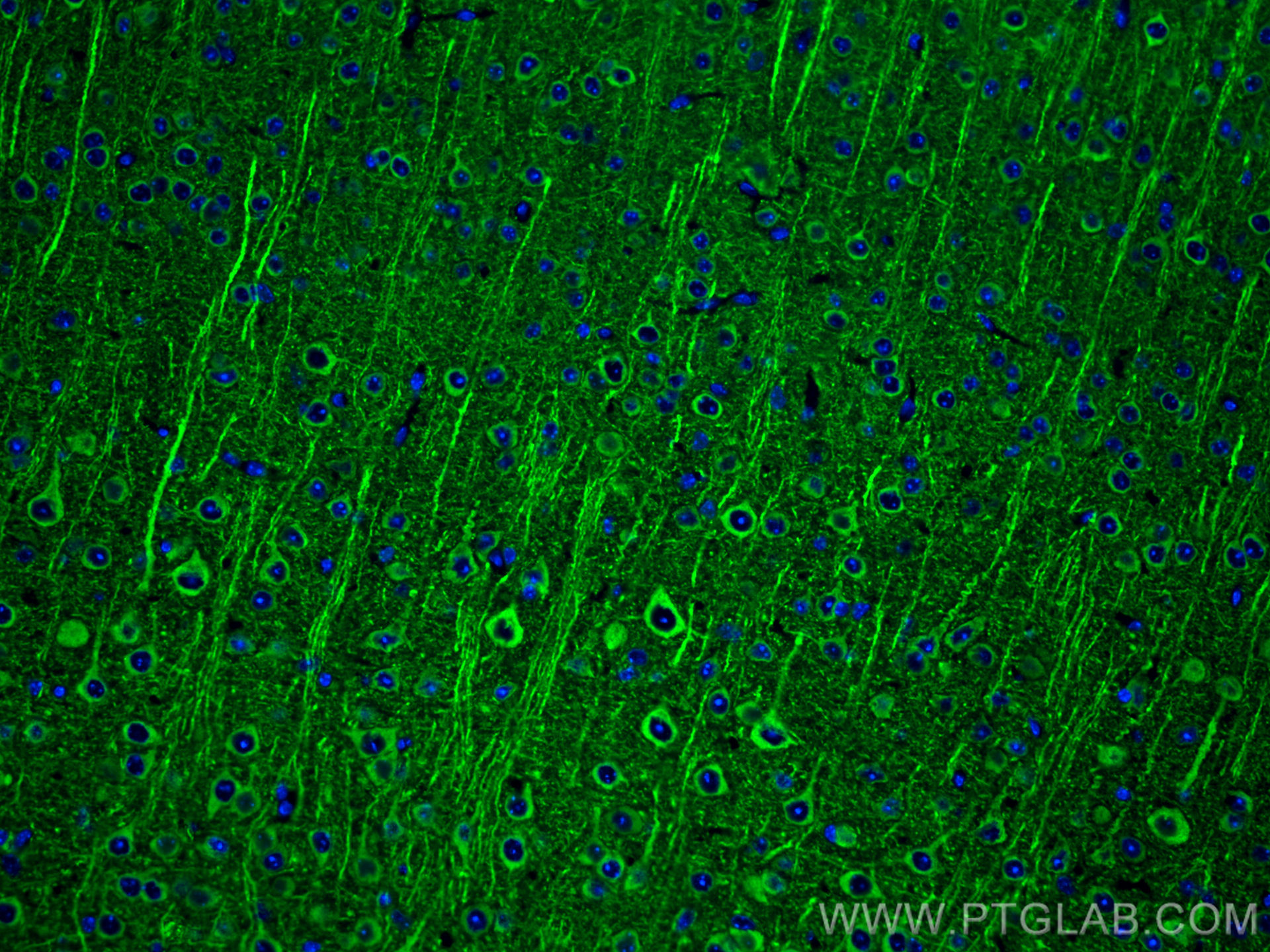 Immunofluorescent analysis of (4% PFA) fixed mouse brain tissue using MAP2 antibody (17490-1-AP) at dilution of 1:200 and CoraLite®488-Conjugated AffiniPure Goat Anti-Rabbit IgG(H+L).