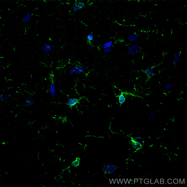 Immunofluorescent analysis of (4% PFA) fixed rat brain tissue using IBA1 antibody (81728-1-RR, Clone: 4D5 ) at dilution of 1:500 and CoraLite®488-Conjugated AffiniPure Goat Anti-Rabbit IgG(H+L).