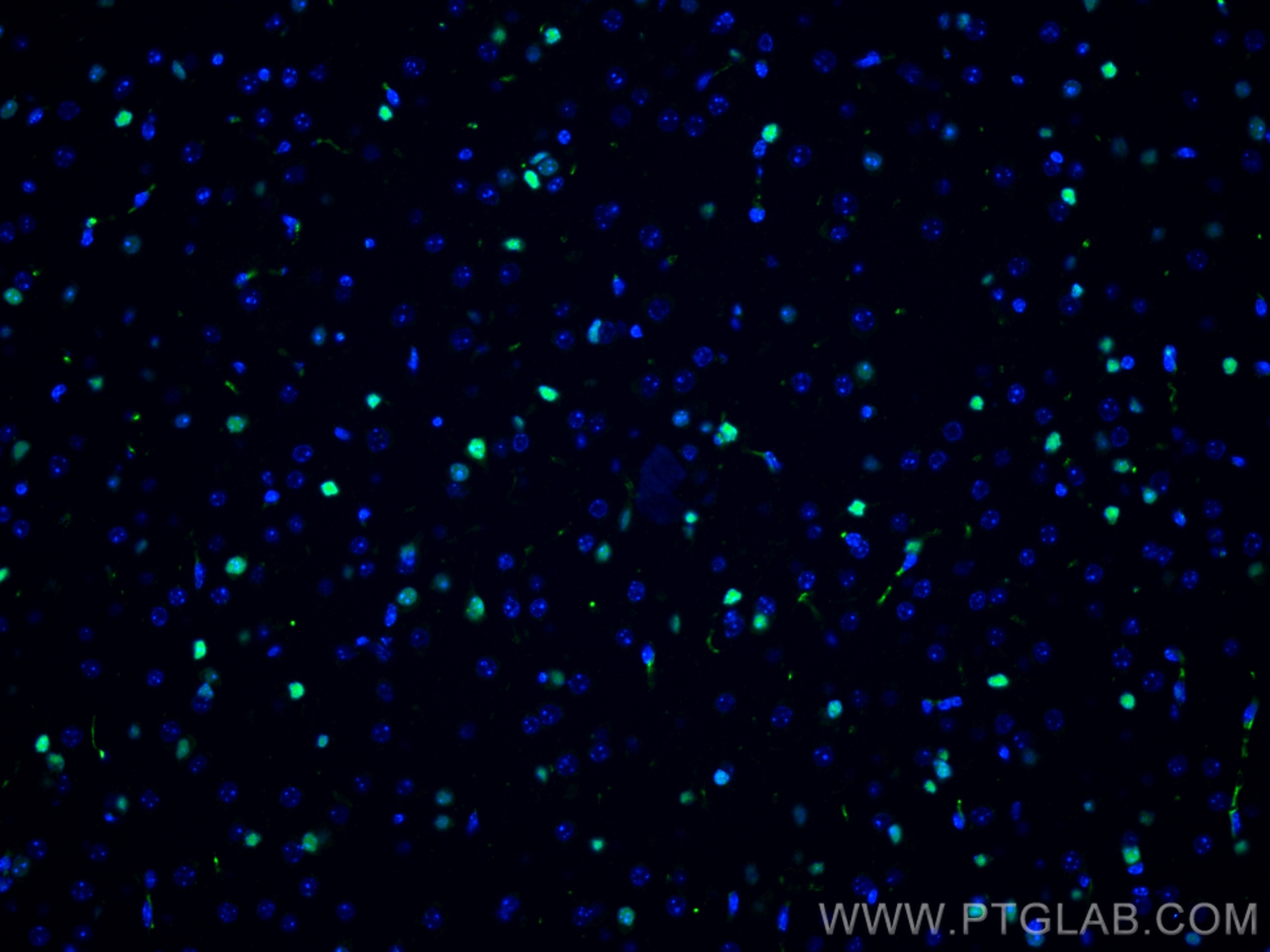 Immunofluorescent analysis of (4% PFA) fixed mouse brain tissue using SOX2 antibody (66411-1-Ig, Clone: 4B9B10 ) at dilution of 1:1000 and CoraLite®488-Conjugated AffiniPure Goat Anti-Mouse IgG(H+L).