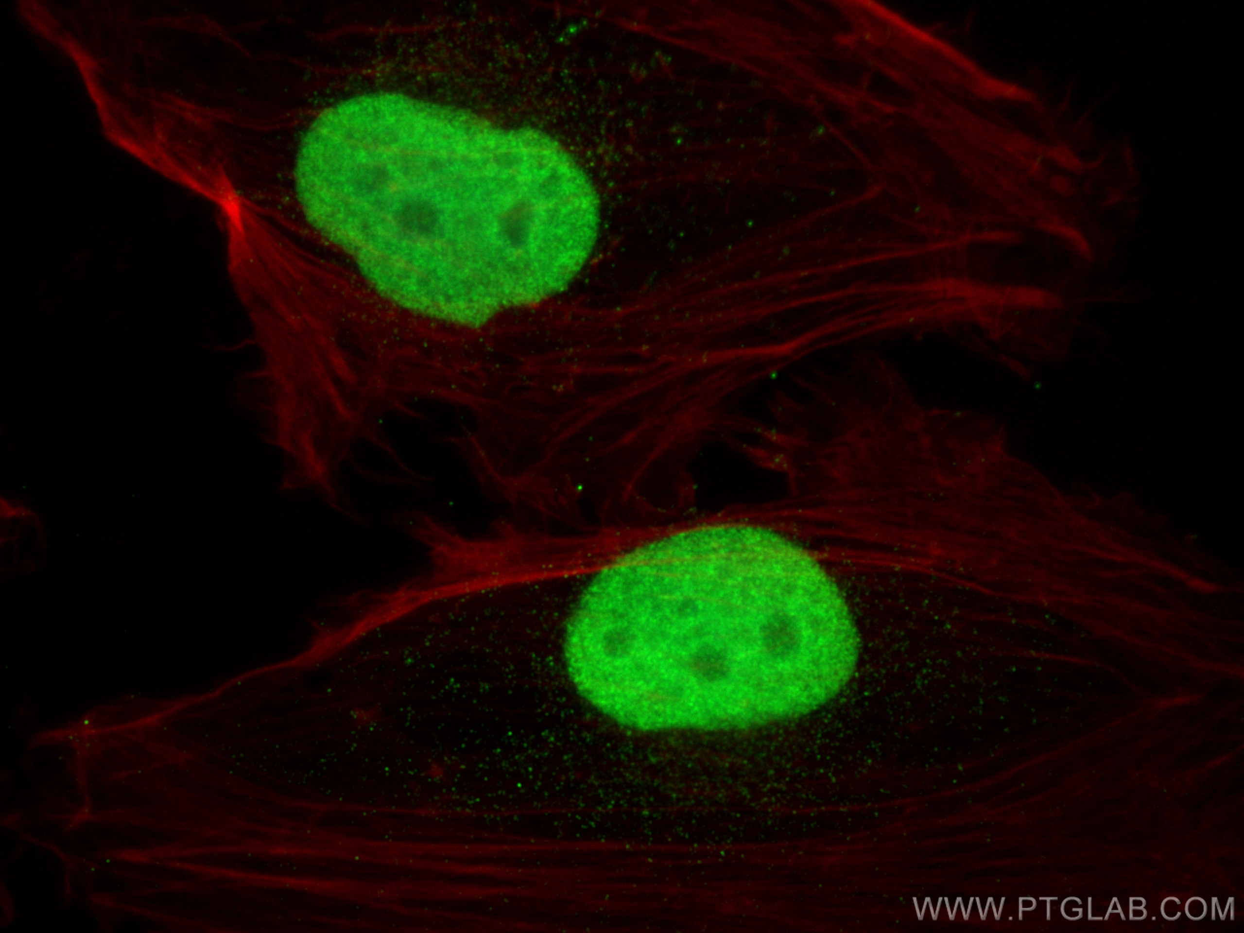 Immunofluorescent analysis of (4% PFA) fixed U-251 cells using SOX2 antibody (66411-1-Ig, Clone: 4B9B10 ) at dilution of 1:2000 and Multi-rAb CoraLite ® Plus 488-Goat Anti-Mouse Recombinant Secondary Antibody (H+L) (RGAM002), CL594-Phalloidin (red).