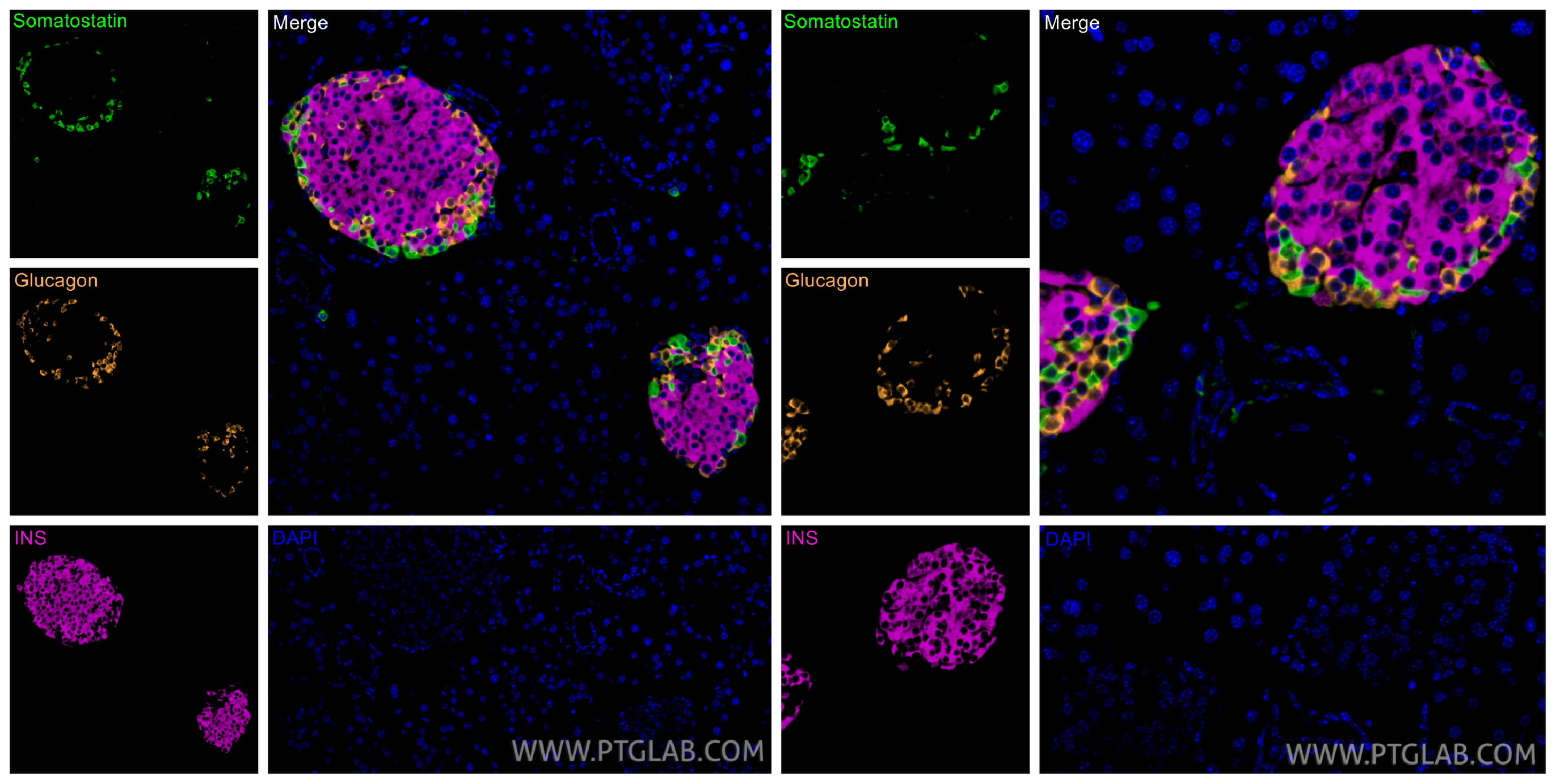 Immunofluorescent analysis of (4% PFA) fixed paraffin-embedded mouse pancreas tissue using Somatostatin antibody 84351-1-RR at dilution of 1:200 with CoraLite®Plus 488-Tyramide reagent(green), INS antibody 15848-1-AP at dilution of 1:200 with CoraLite®Plus 647-Tyramide reagent(magenta), Glucagon antibody 15954-1-AP with CoraLite®Plus 555-Tyramide reagent(orange). Heat mediated antigen retrieval with Tris-EDTA buffer (pH 9.0).