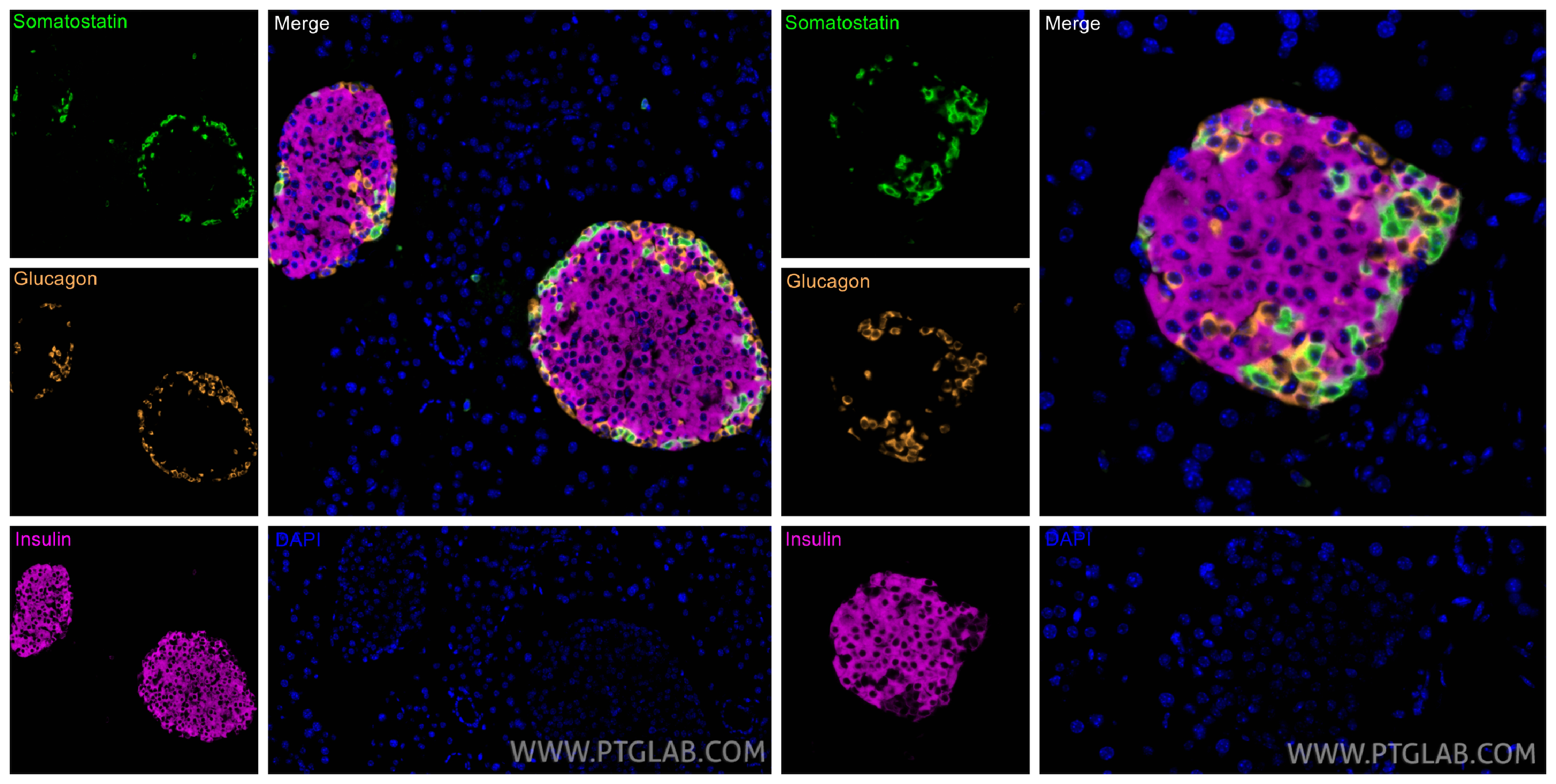 Immunofluorescent analysis of (4% PFA) fixed paraffin-embedded mouse pancreas tissue using Somatostatin antibody 17512-1-AP at dilution of 1:200 with CoraLite®Plus 488-Tyramide reagent(green), INS antibody 15848-1-AP at dilution of 1:200 with CoraLite®Plus 647-Tyramide reagent(magenta), Glucagon antibody 15954-1-AP with CoraLite®Plus 555-Tyramide reagent(orange). Heat mediated antigen retrieval with Tris-EDTA buffer (pH 9.0).