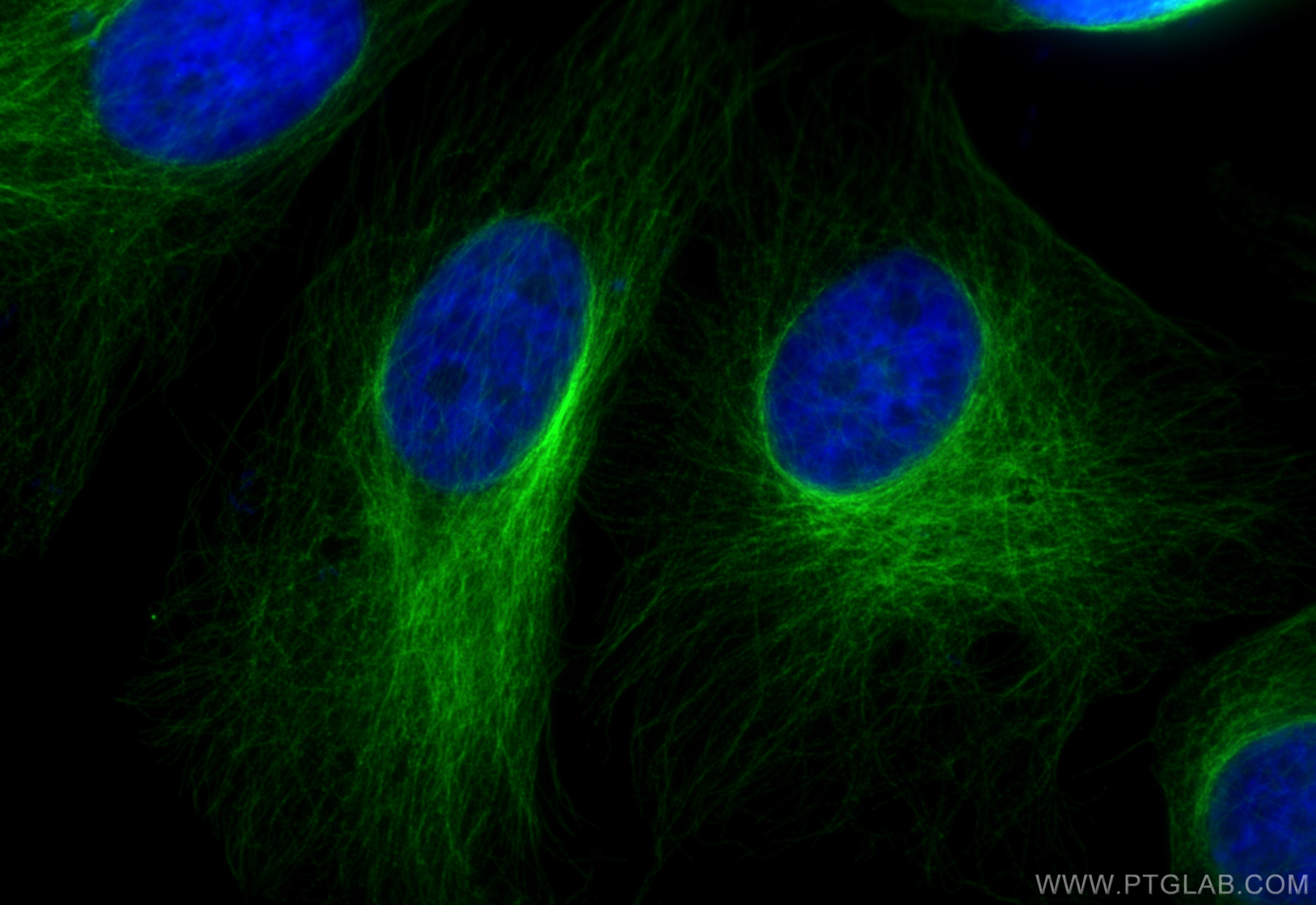 Immunofluorescent analysis of (4% PFA) fixed HeLa cells using Alpha Tubulin antibody (66031-1-Ig, Clone: 1E4C11 ) at dilution of 1:400 and CoraLite®488-Conjugated AffiniPure Donkey Anti-Mouse IgG(H+L) (SA00013-5).