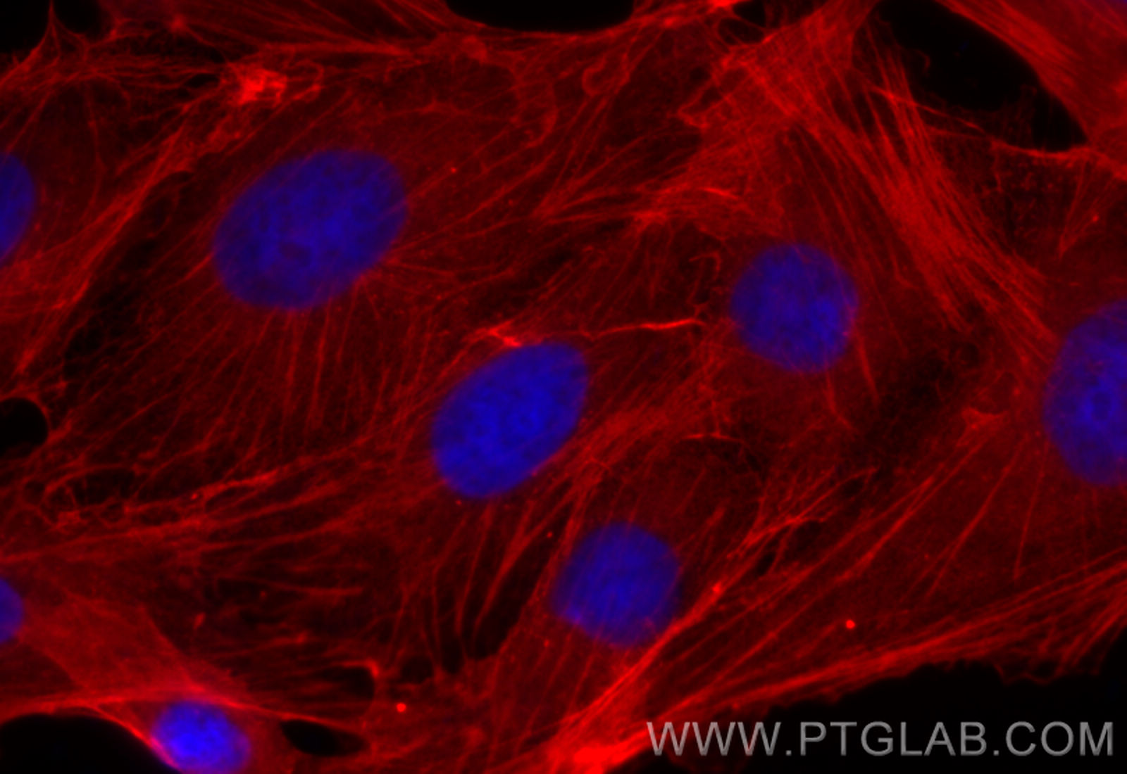 Immunofluorescent analysis of (-20°C Methanol) fixed MDCK cells using Beta Actin antibody (66009-1-Ig, Clone: 2D4H5 ) at dilution of 1:400 and CoraLite594 - conjugated Donkey Anti-Mouse IgG(H+L)(SA00013-7).