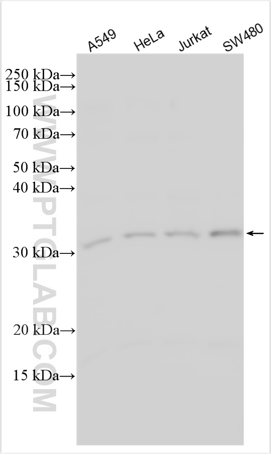 WB analysis using 31061-1-AP (same clone as 31061-1-PBS)