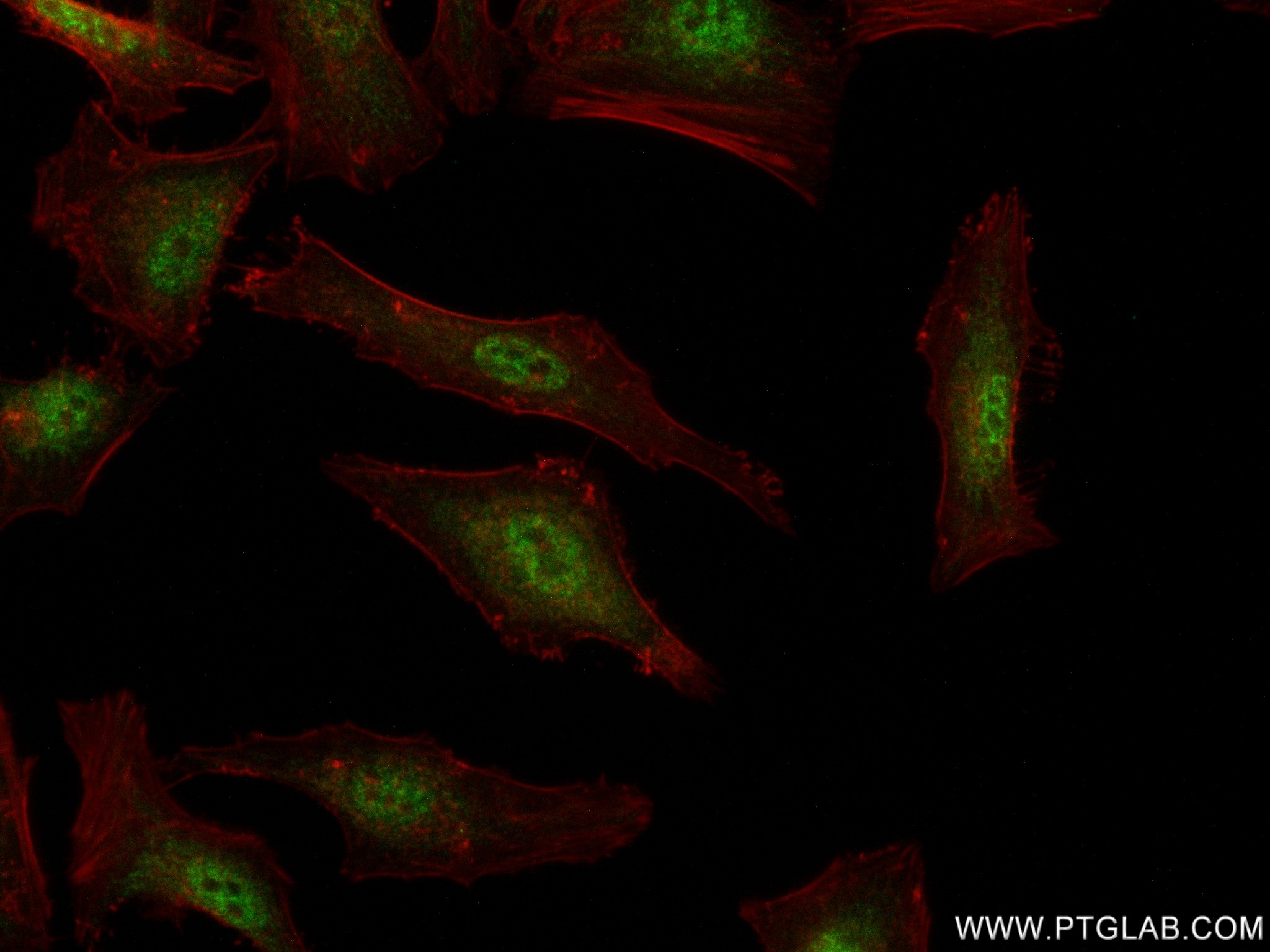 IF Staining of HeLa using 83160-2-RR (same clone as 83160-2-PBS)