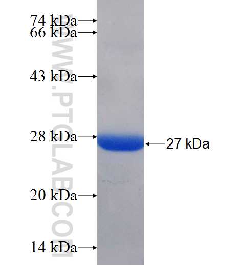 IFI44 fusion protein Ag25974 SDS-PAGE